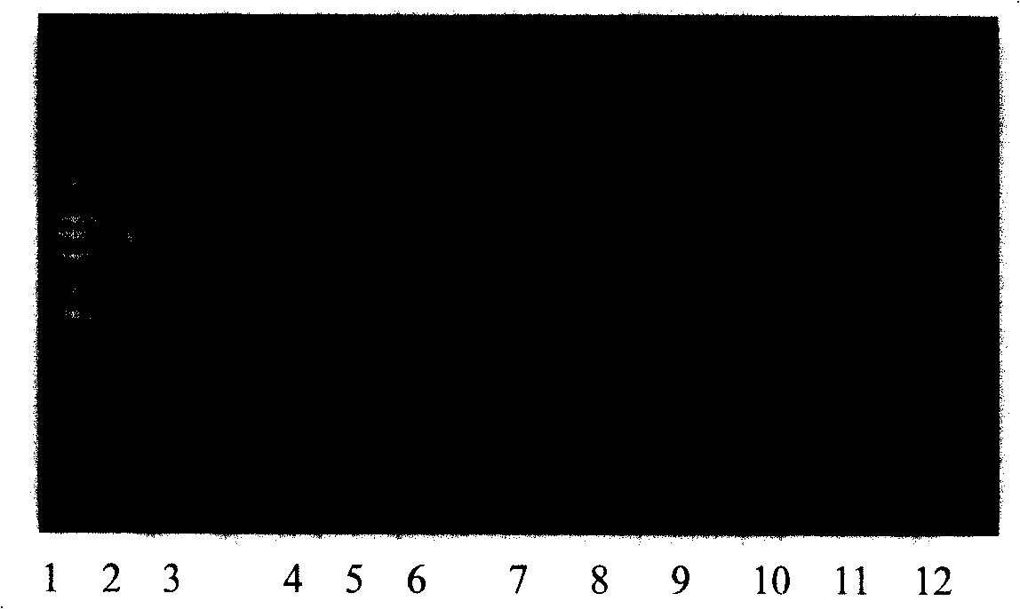 Multiple real time fluorescence quantifying PCR method for detecting porcine circovirus, porcine parvovirus, porcine pseudorabies virus and classical swine fever virus