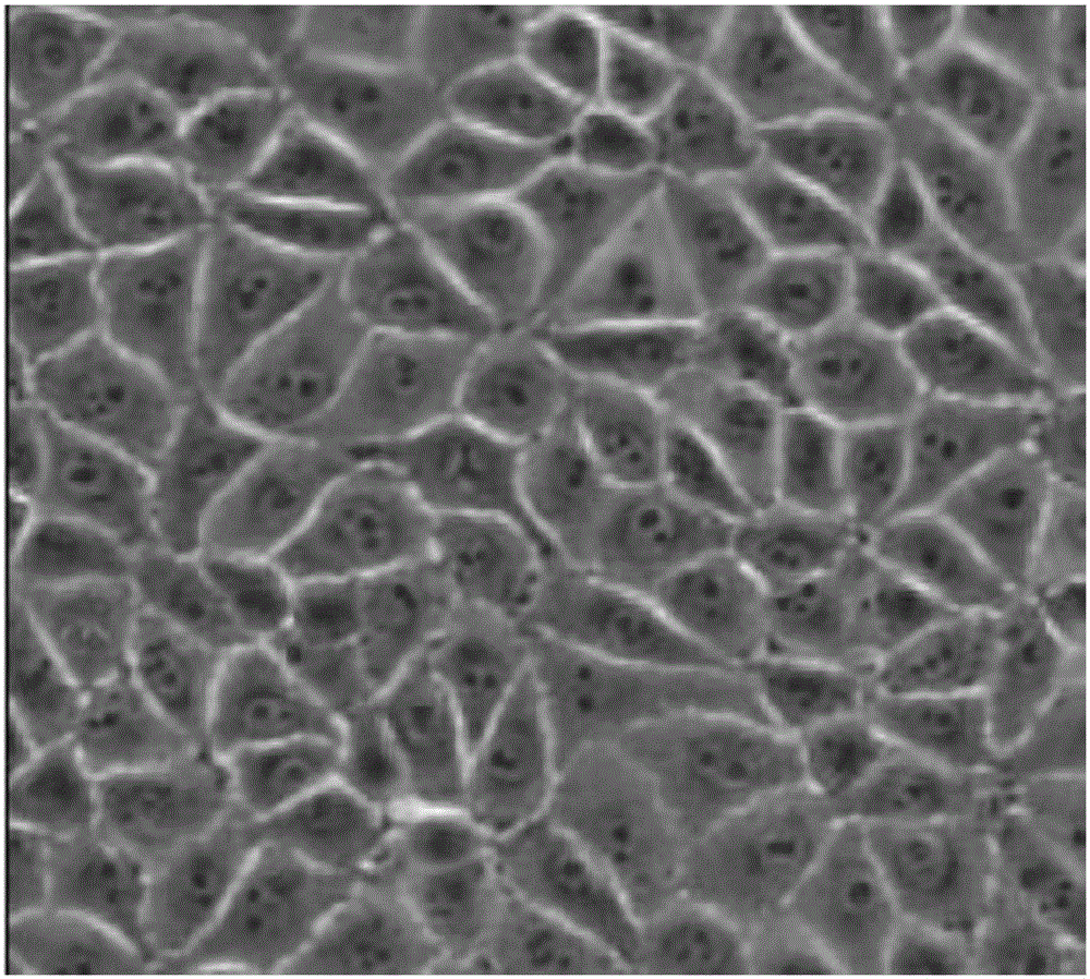 Low-serum culture method of PK15 cells, PK15 cells obtained by method and application thereof