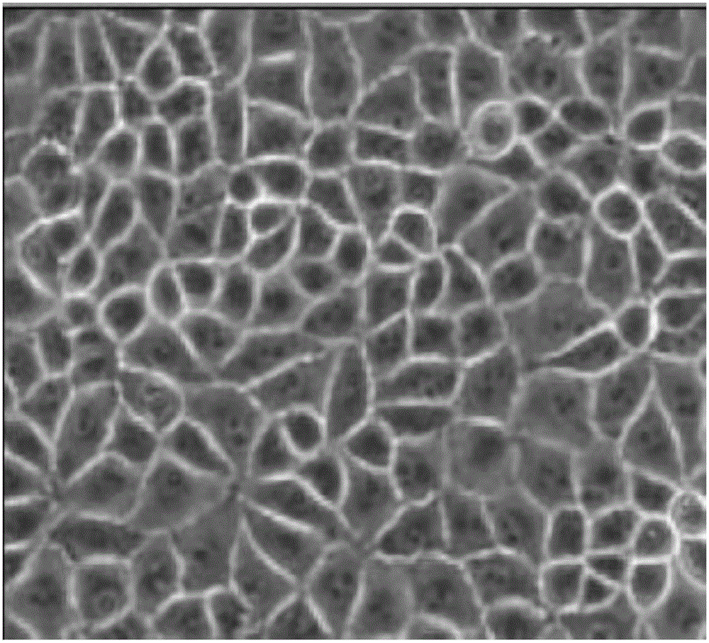 Low-serum culture method of PK15 cells, PK15 cells obtained by method and application thereof