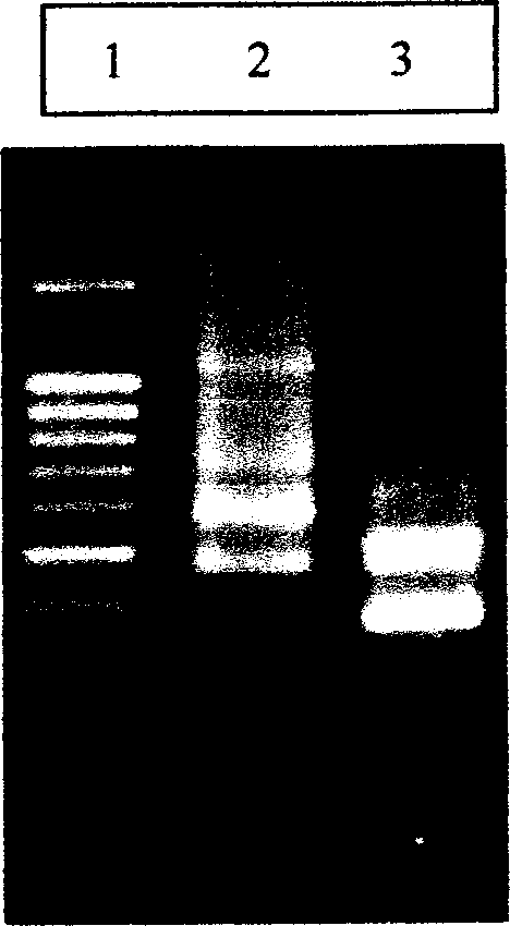 Recombined rockfish adenylate cyclase activated polypeptide gene and its expression system, expression product, producing method and use