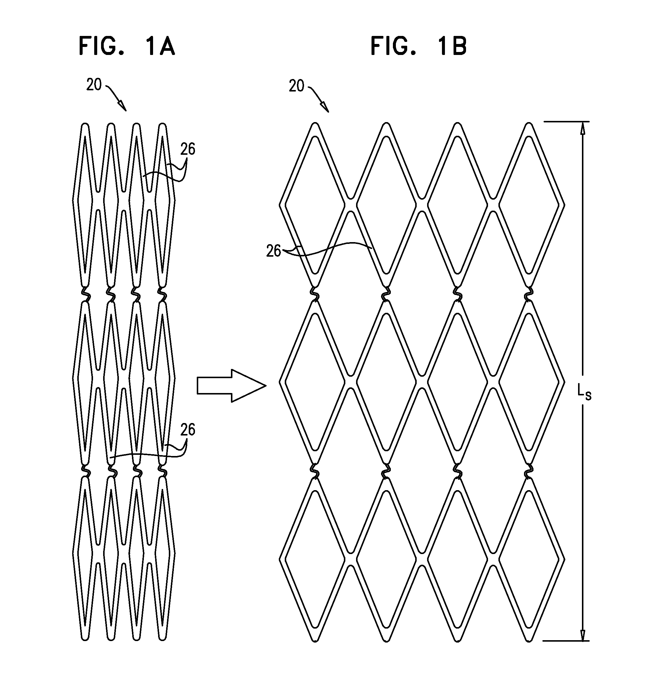 Double-layer stent