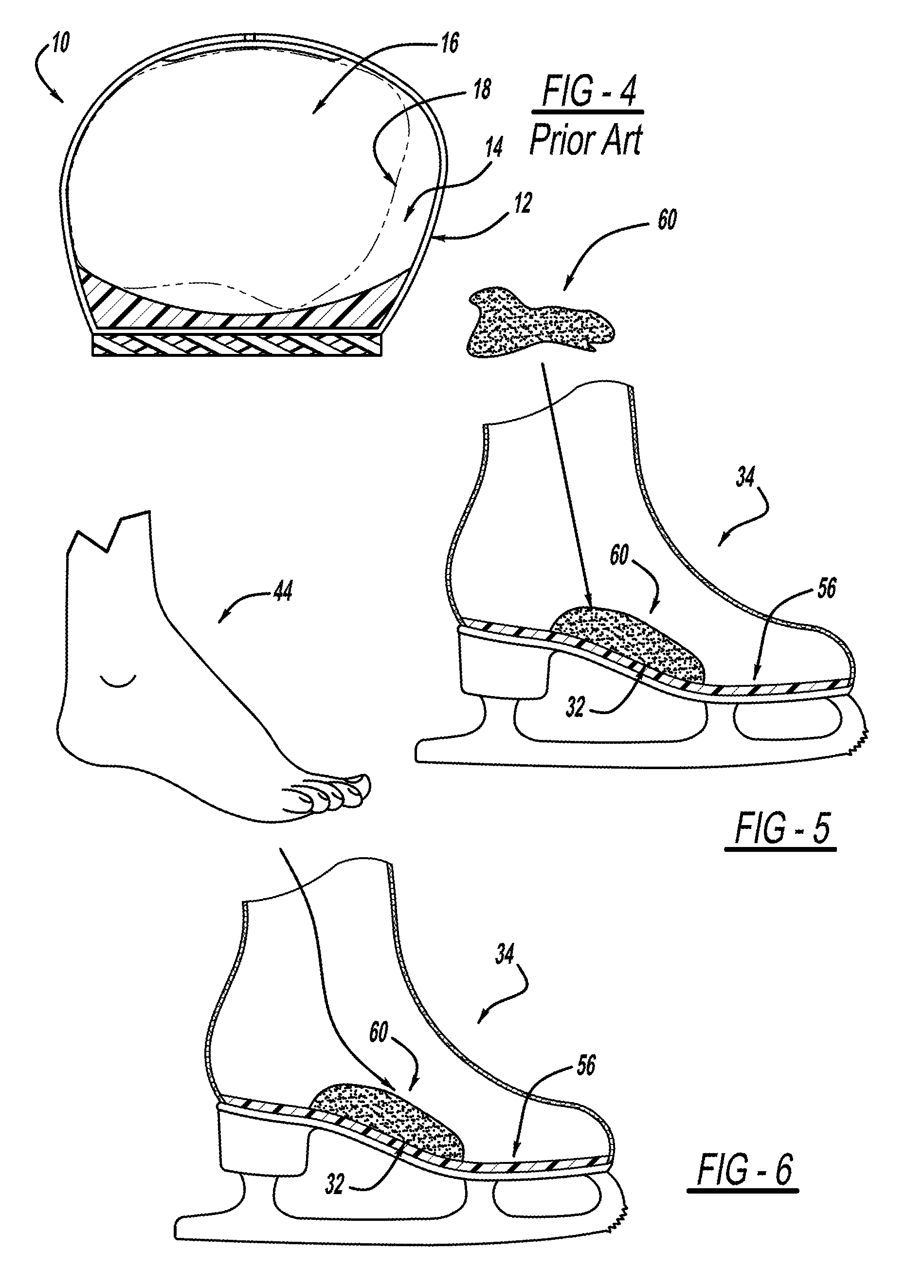 Moldable arch support for footwear