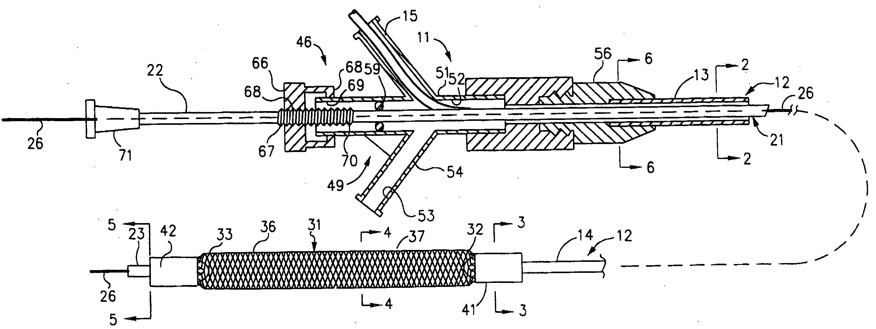 Mechanical apparatus and method for dilating and delivering a therapeutic agent to a site of treatment