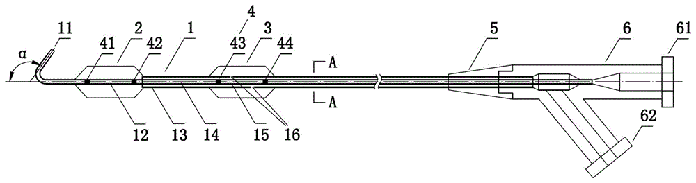 Double-balloon catheter for blocking arteria iliaca communis blood