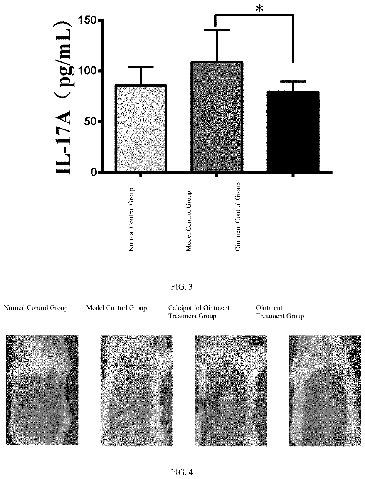 Application of methyl 4-[9-(6-aminopuryl)]-2(s)-hydroxybutyrate in preparation of medicament for treating psoriasis and vitiligo