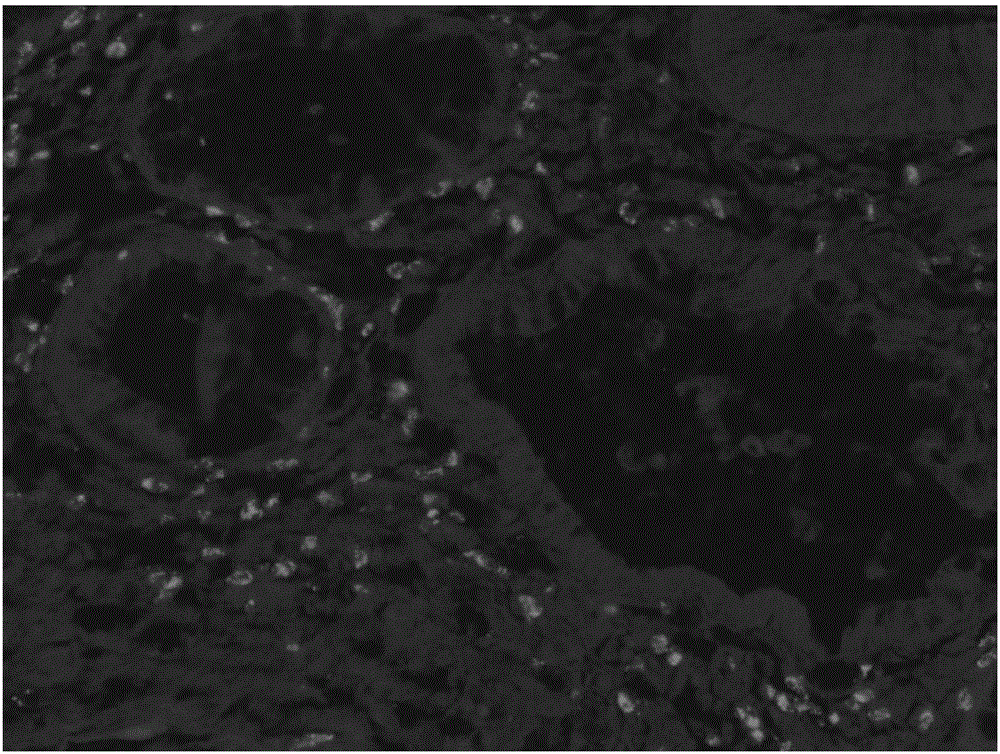 Probe related to colorectal cancer and application thereof