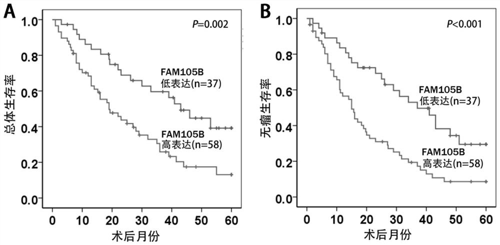 Application of delinearized ubiquitin enzyme family with sequence similarity 105, member B (FAM105B) to liver cancer diagnosis, treatment and prognosis judgment