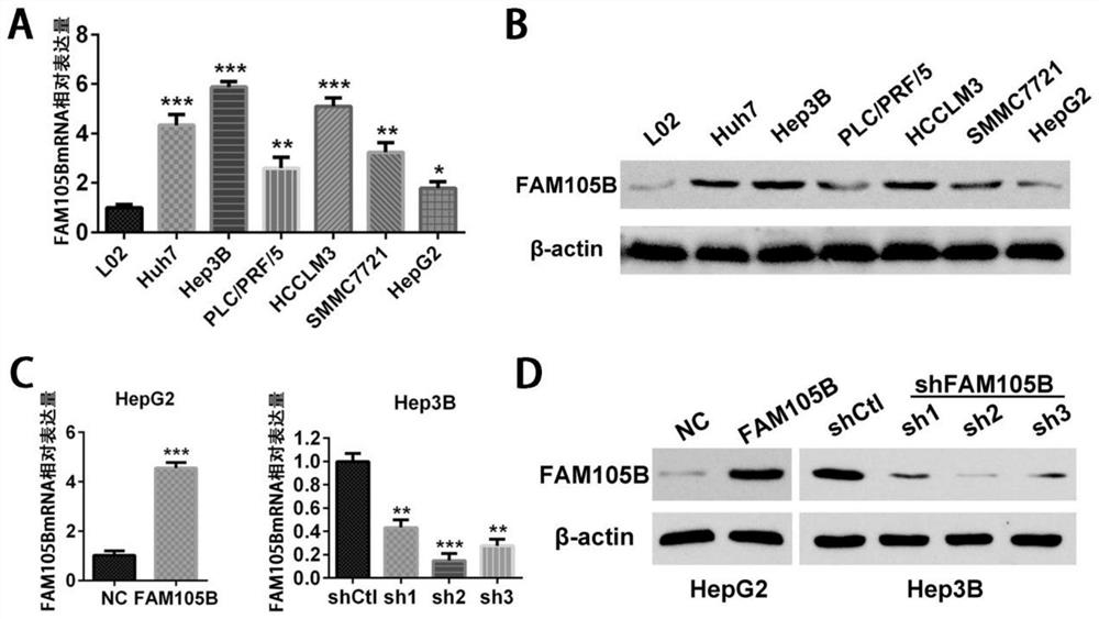 Application of delinearized ubiquitin enzyme family with sequence similarity 105, member B (FAM105B) to liver cancer diagnosis, treatment and prognosis judgment