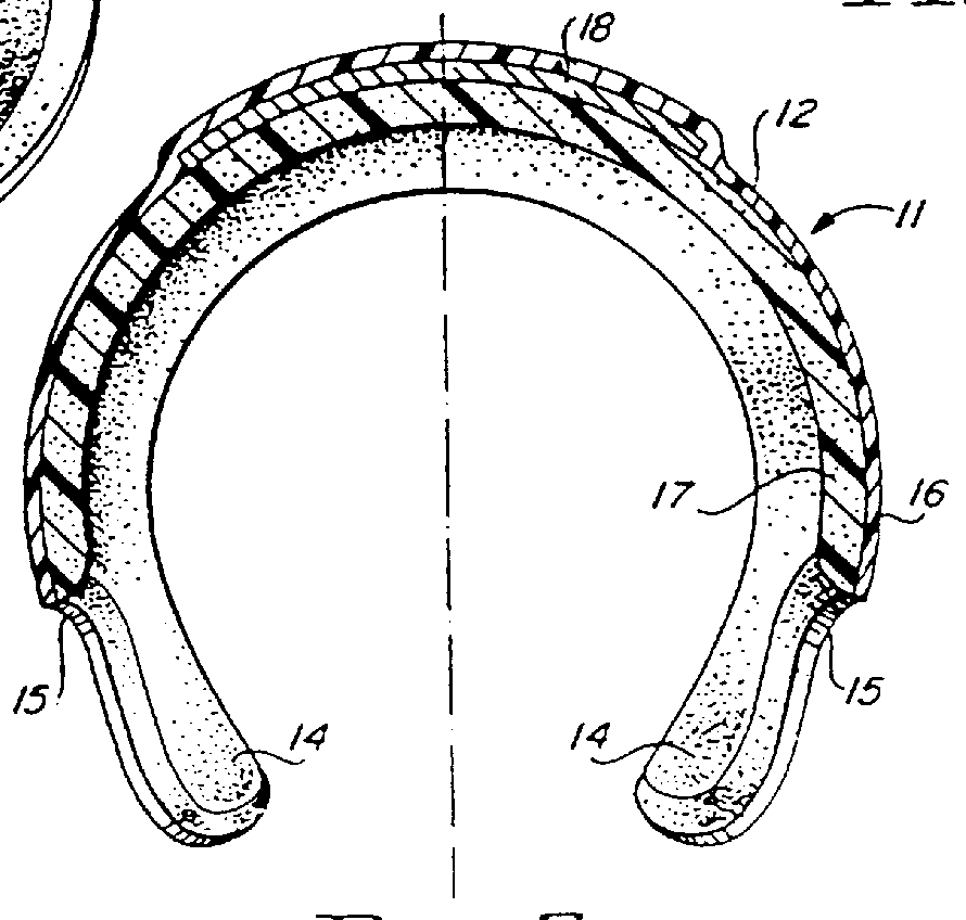 Cranial remodeling orthosis