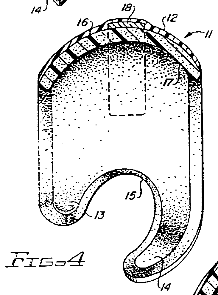 Cranial remodeling orthosis