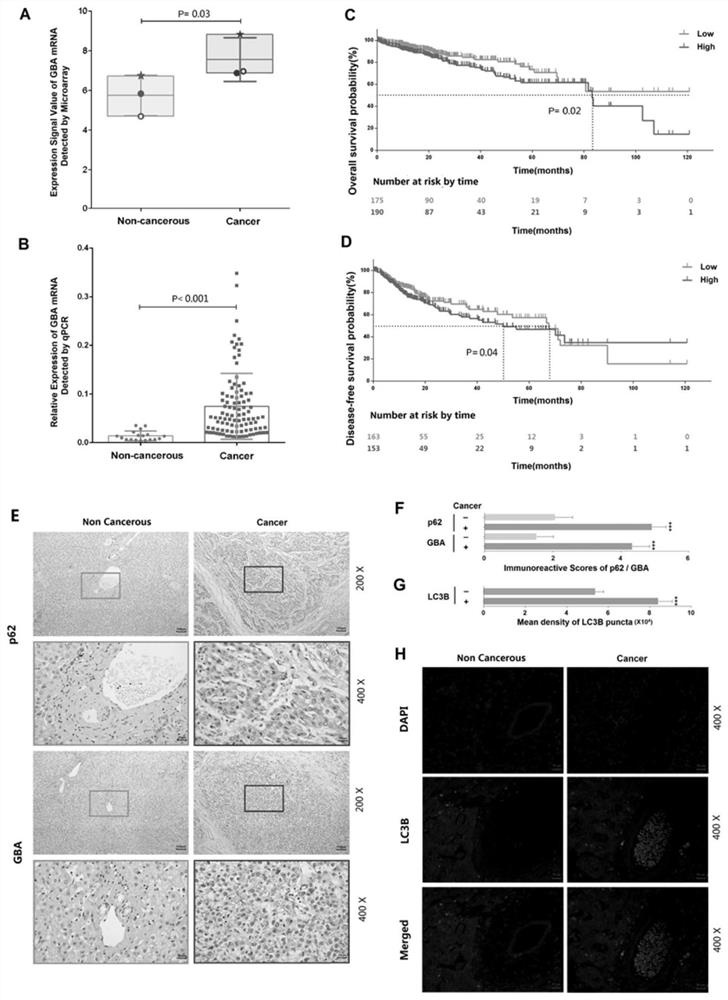 Application of reagent targeting biomarker in preparation of medicine for relieving/treating liver cancer