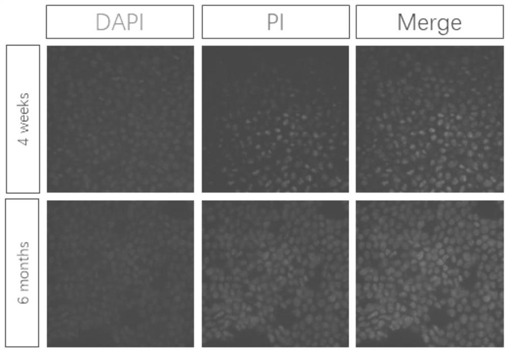 A kind of preparation method and application of cell, tissue or organ cold preservation solution