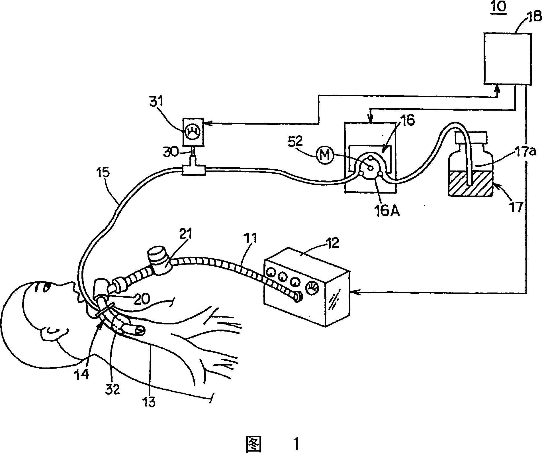 Tracheal cannula