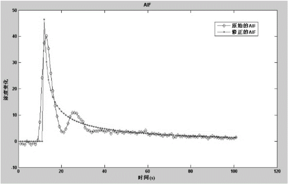 Magnetic resonance perfusion imaging postprocessing method and system thereof