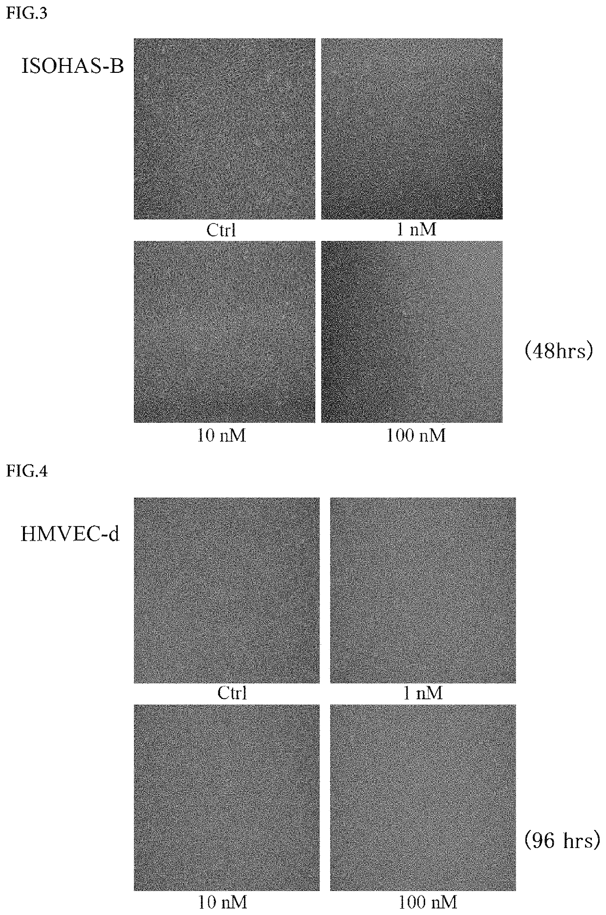 External preparation for treating a vascular anomaly