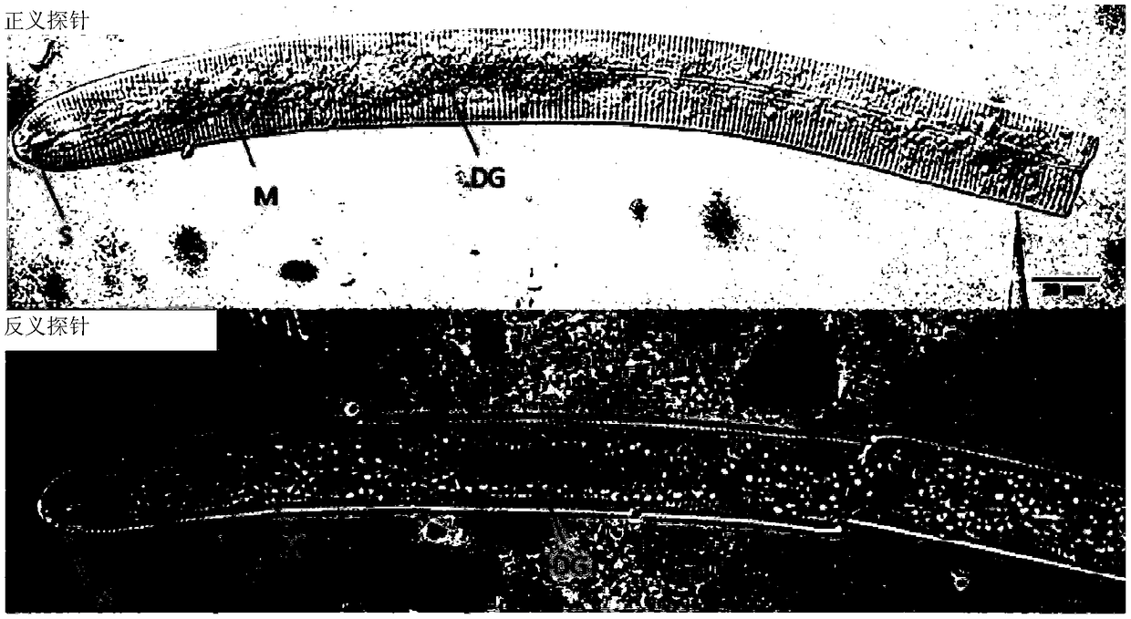 HaGLAND5 protein of cereal cyst nematode, encoding gene of protein and application