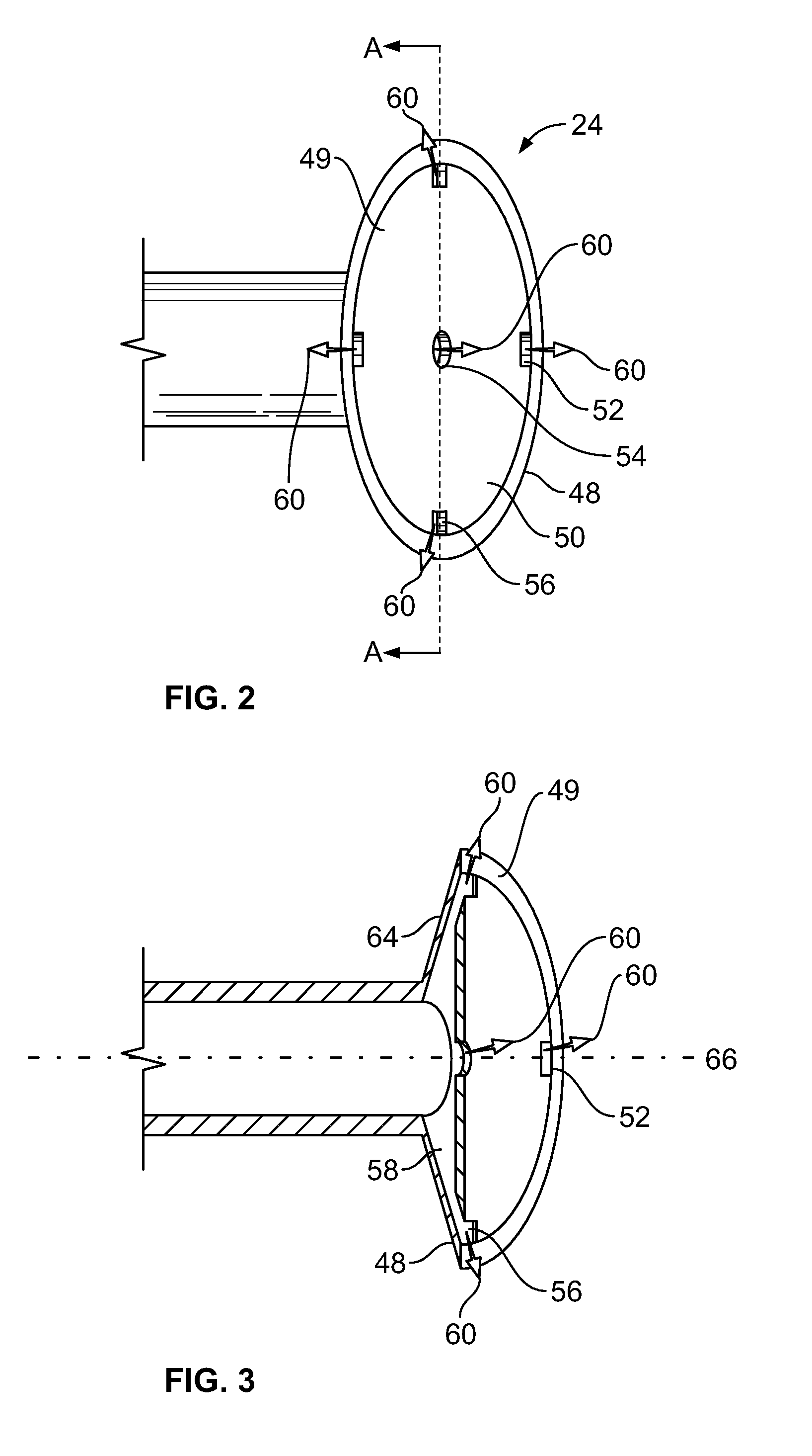 Transanal irrigation kit