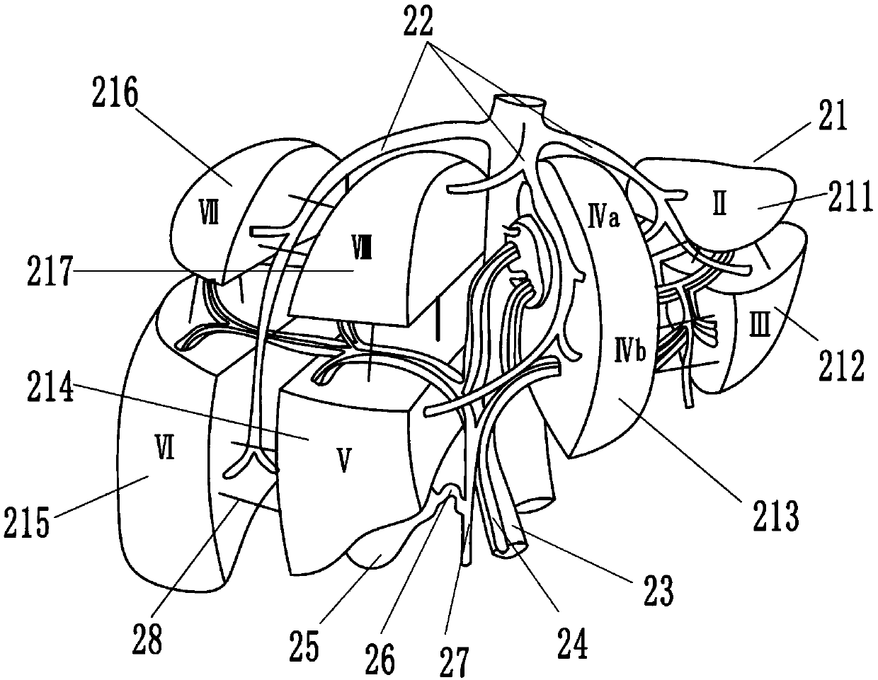 Laparoscopic liver operation simulation training system