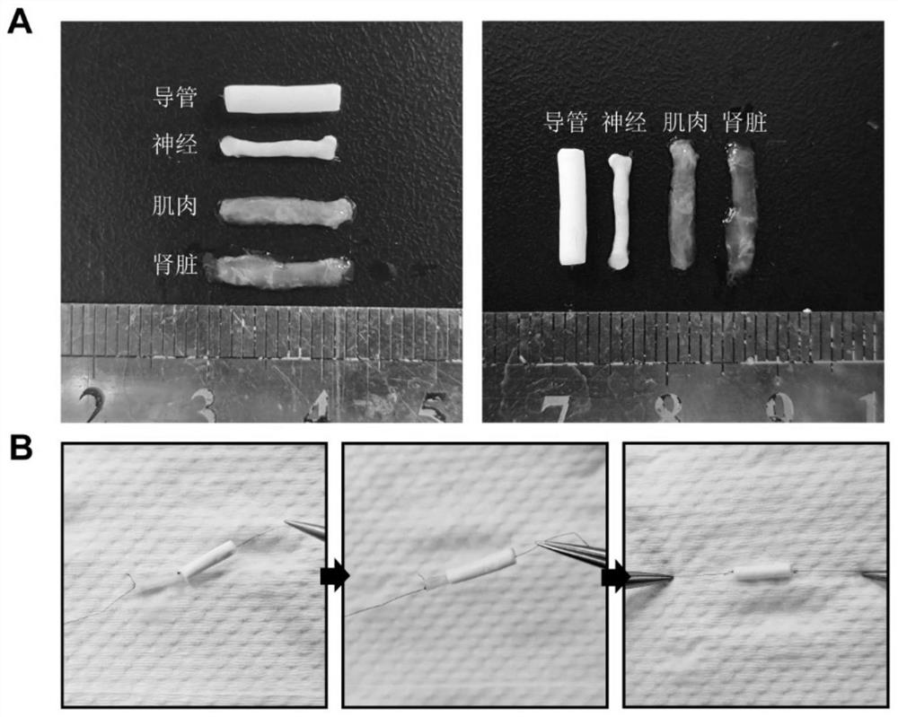 Artificial nerve conduit with PLGA (poly (lactic-co-glycolic acid)) and acellular extracellular matrix as substrates as well as preparation method and device of artificial nerve conduit