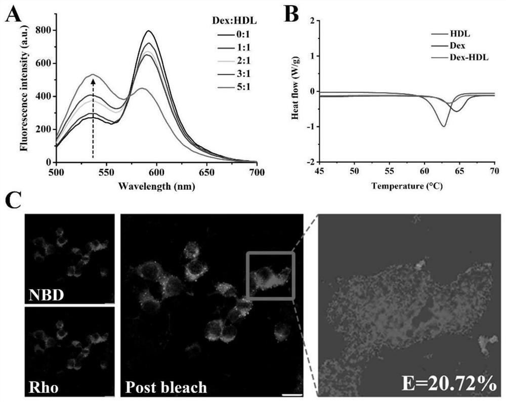 Apolipoprotein modified fusion type multifunctional nano vesicle, and preparation method and application thereof