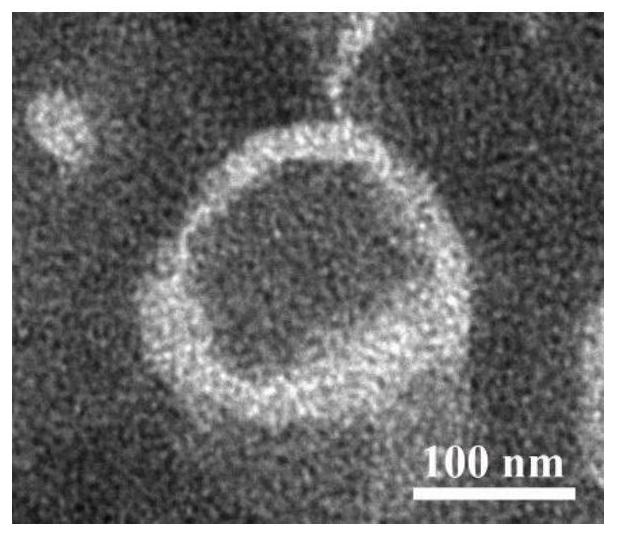 Apolipoprotein modified fusion type multifunctional nano vesicle, and preparation method and application thereof