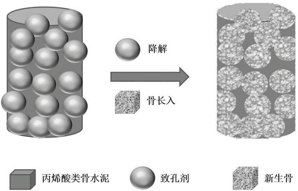 Acrylic compound bone cement with partial degradation function and preparation method of acrylic compound bone cement with partial degradation function