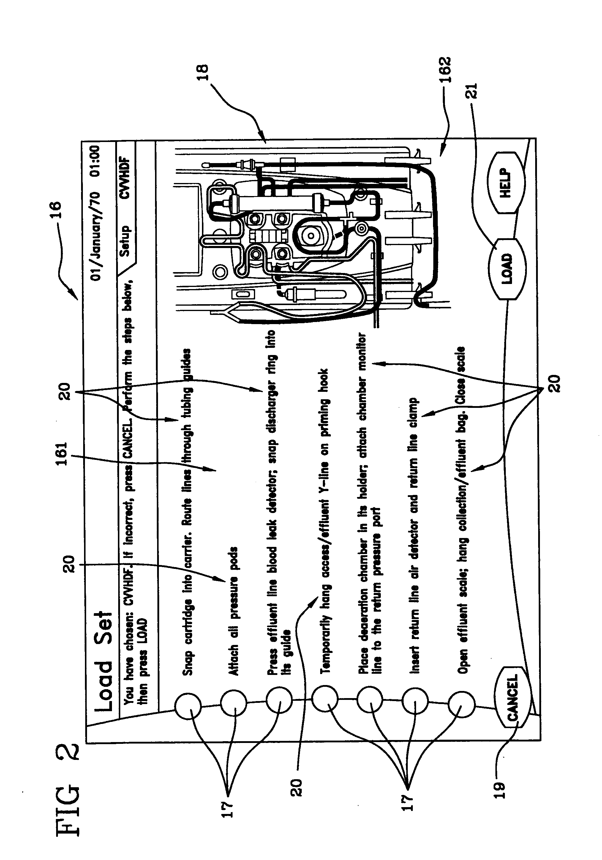 Extracorporeal blood treatment machine