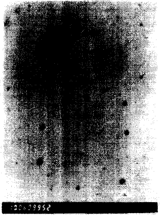 Nano particles of taxane cyclodextrin inclusion compound and preparation method thereof