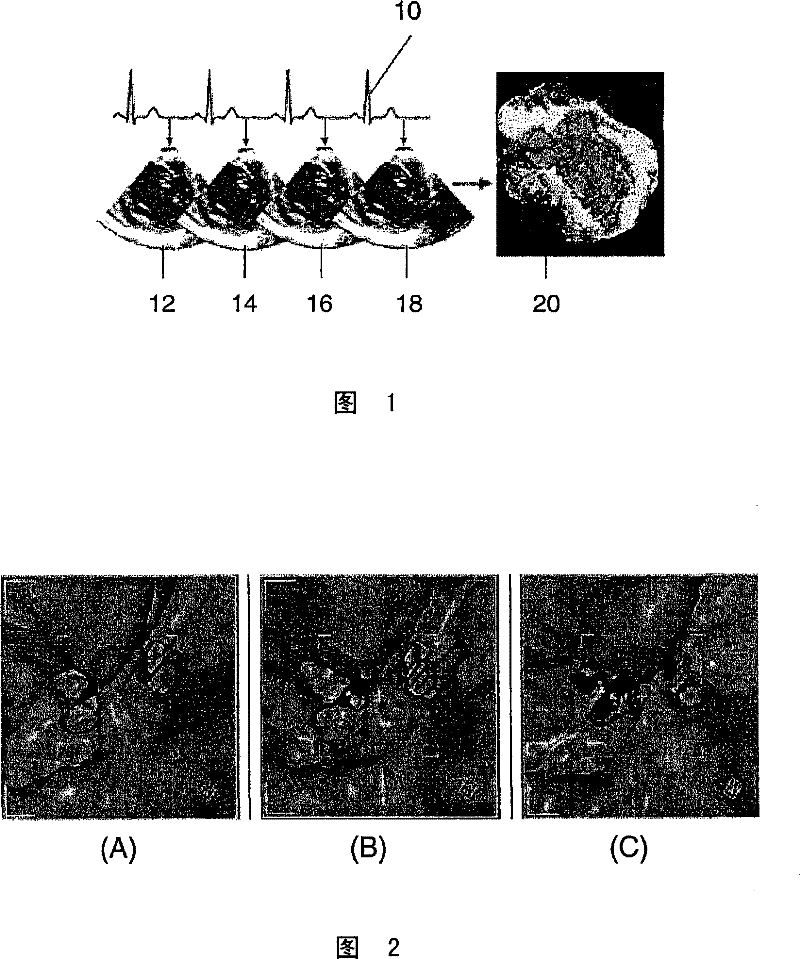 Interactive type four-dimensional dummy endoscopy method and apparatus