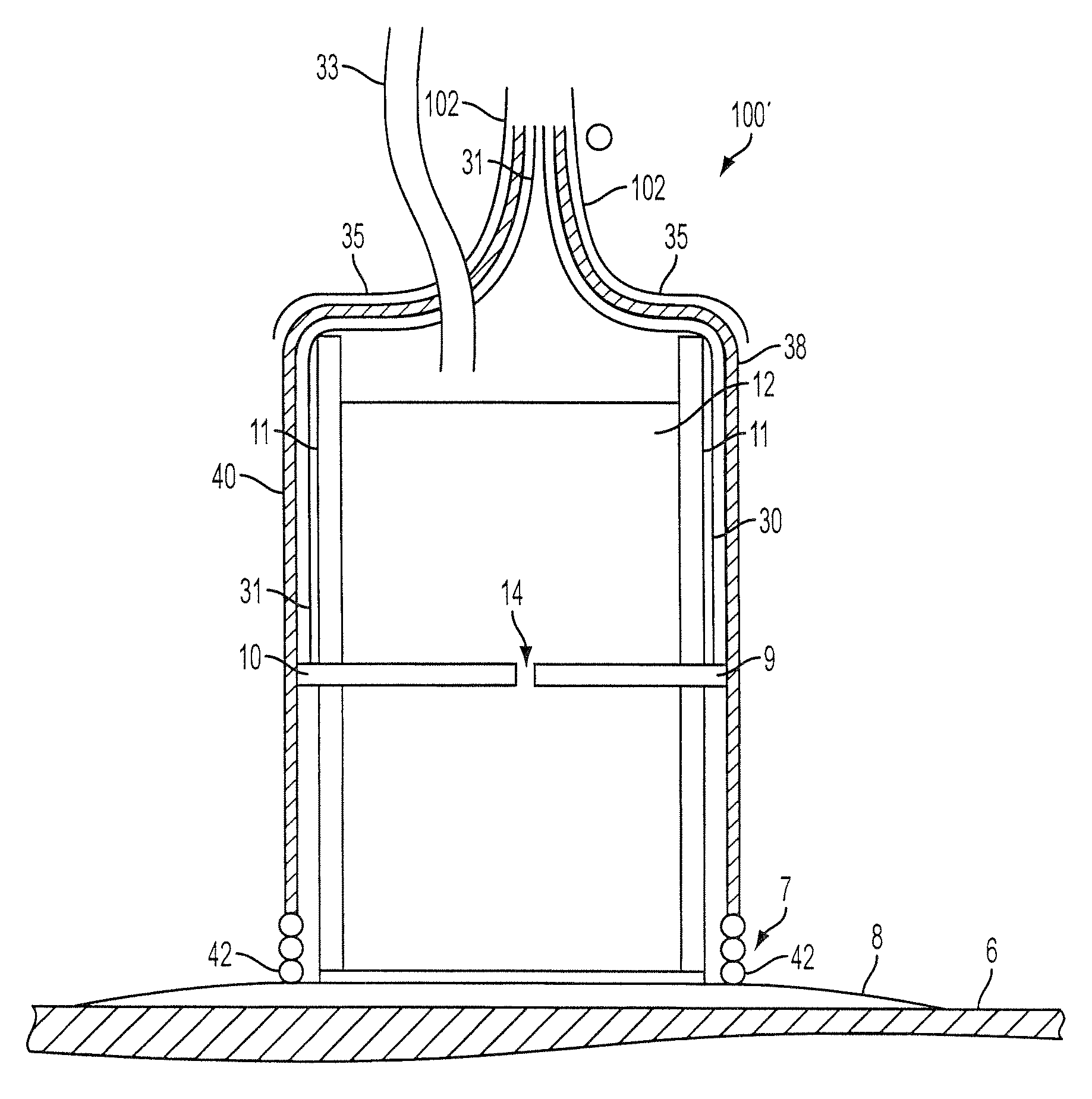 Method for soft tissue treatment