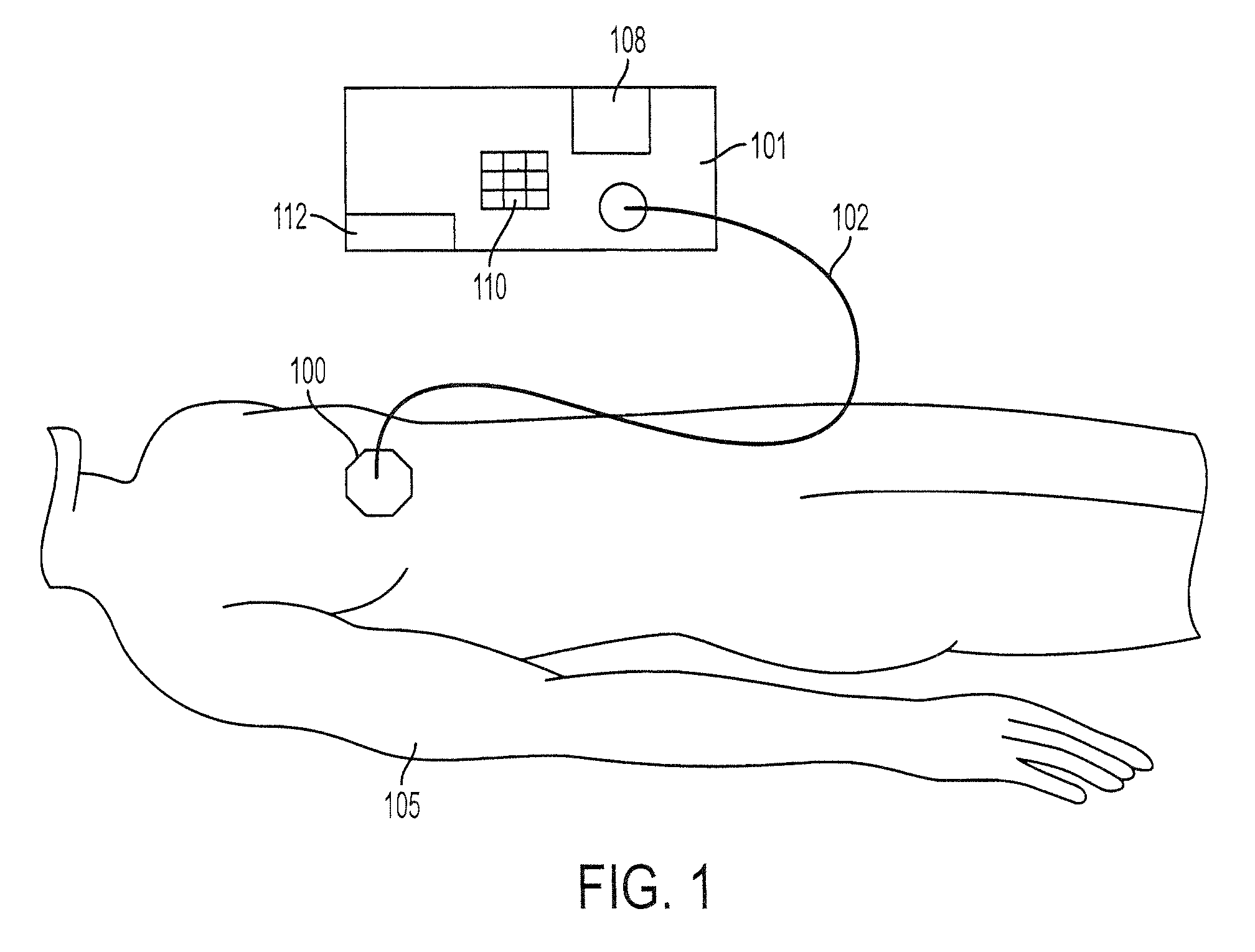 Method for soft tissue treatment