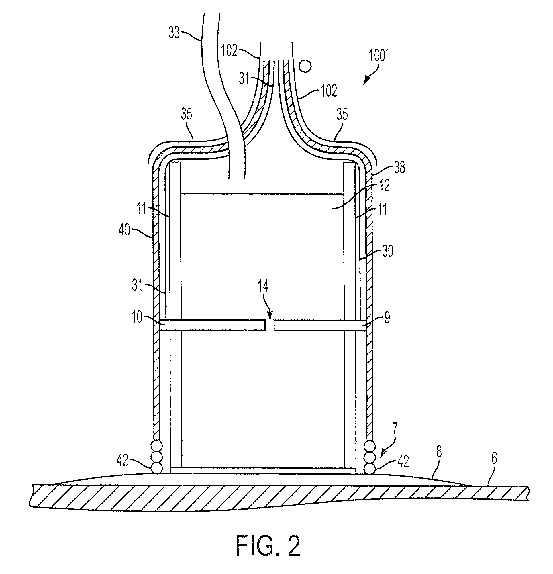 Method for soft tissue treatment