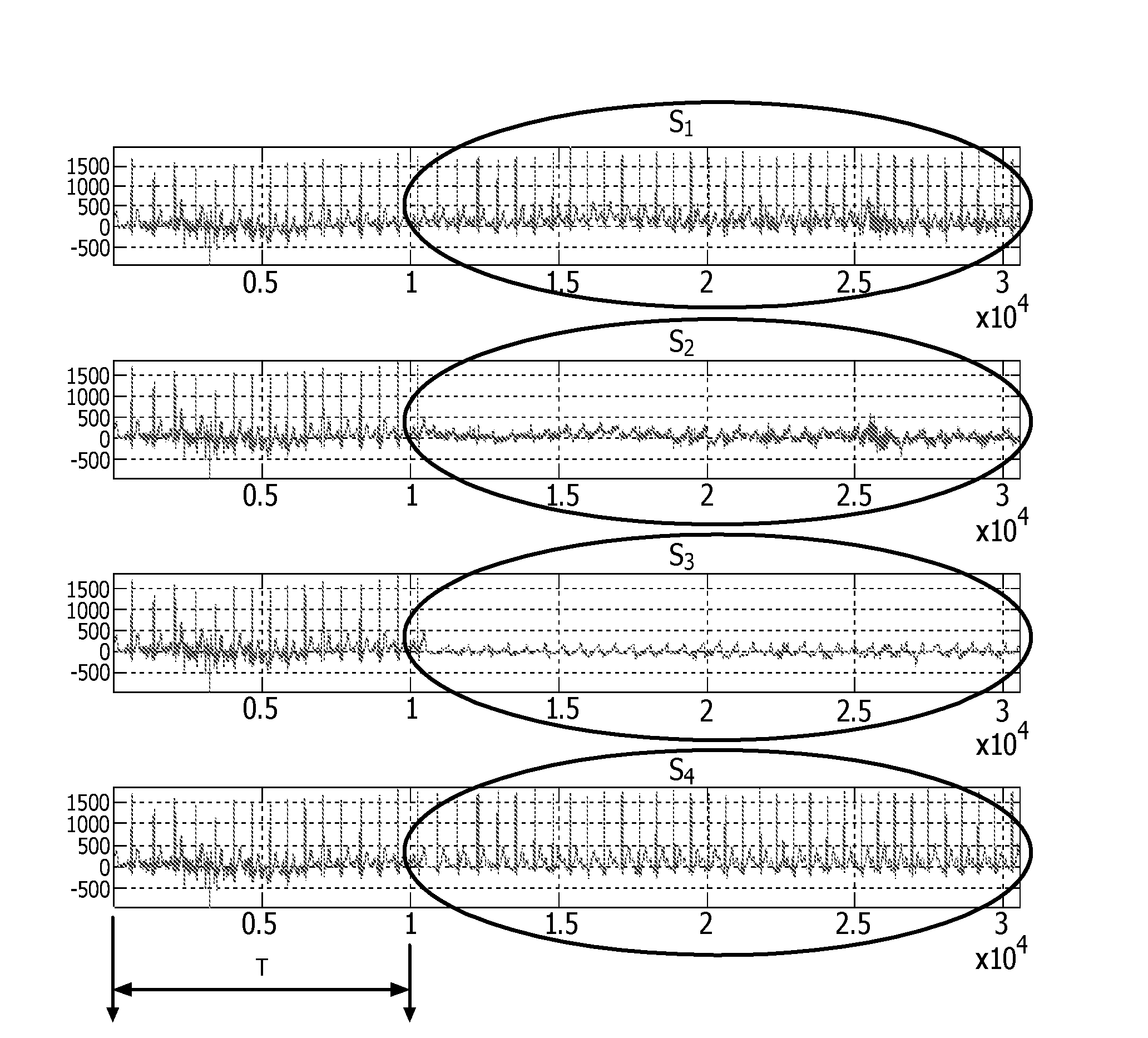 Method and apparatus for reducing motion artifacts in ECG signals