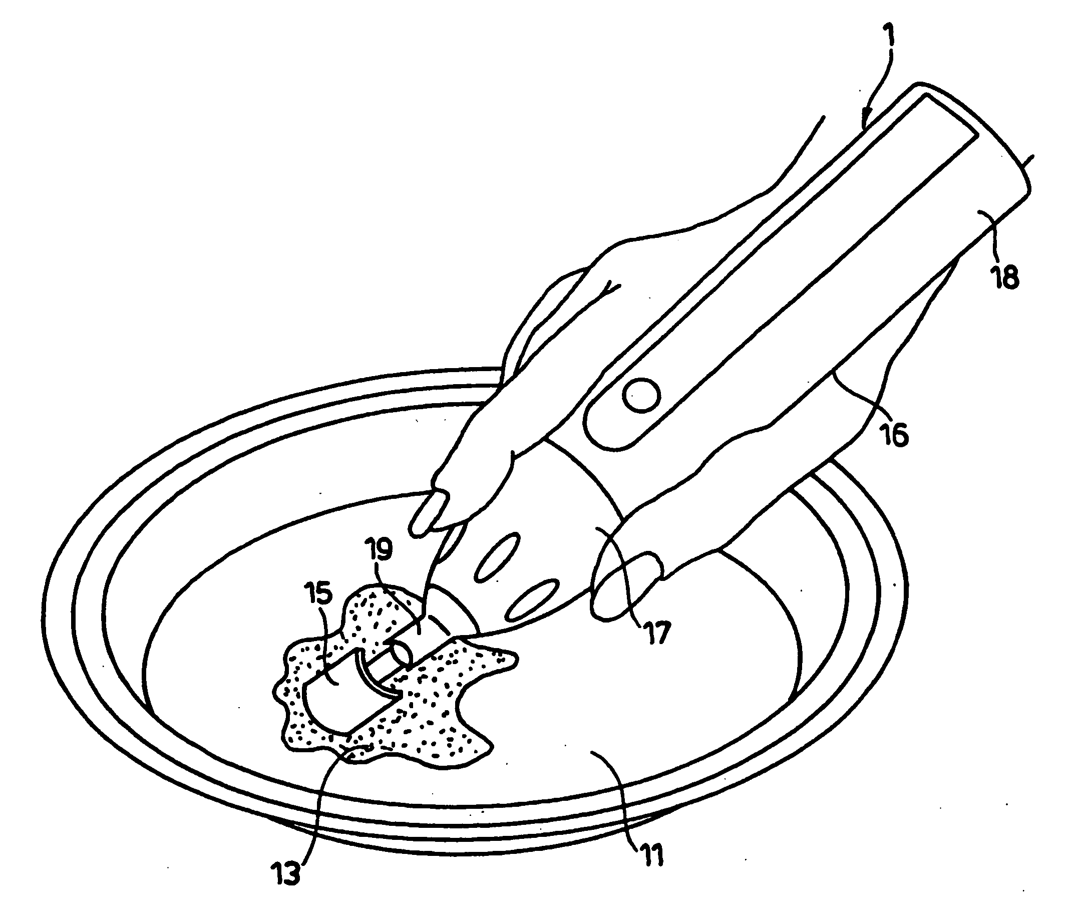 Ultrasonic implement