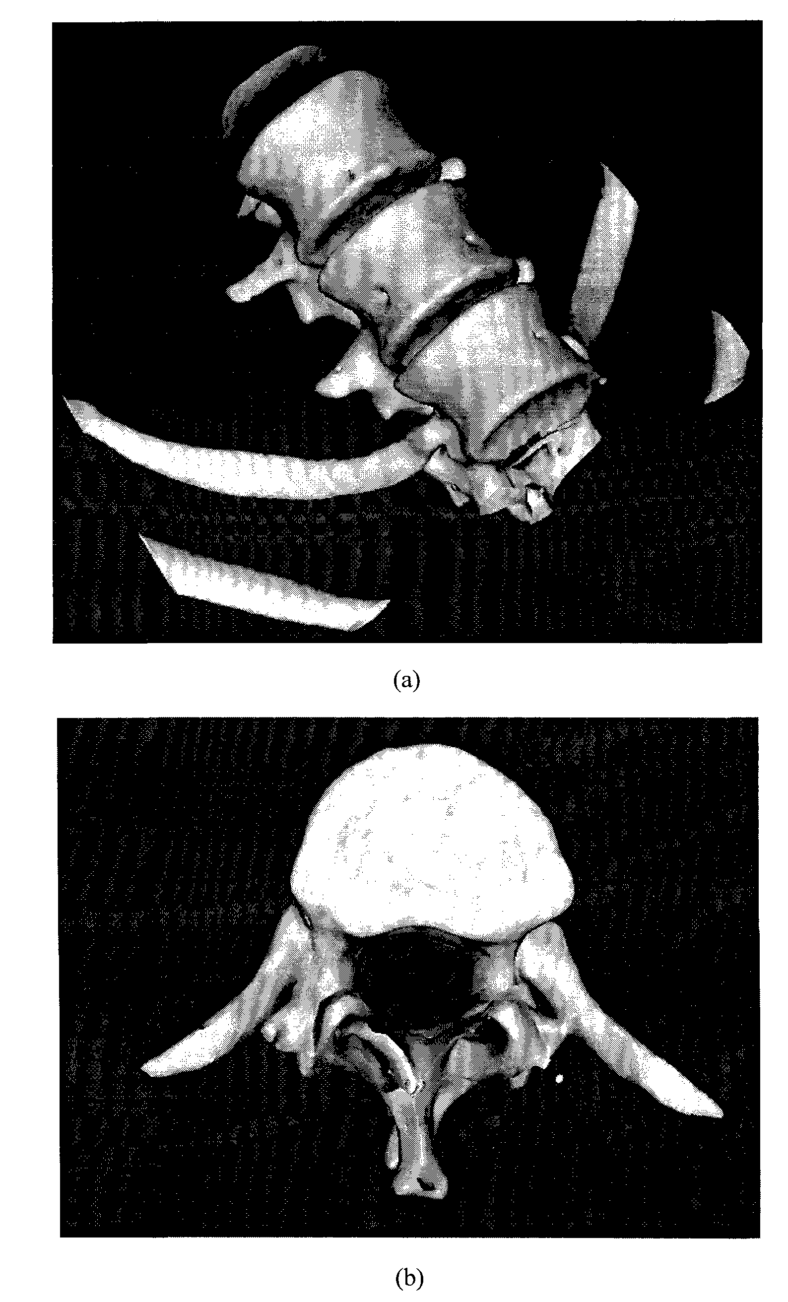 Method for constructing vertebral three-dimensional geometry and finite element mixture model