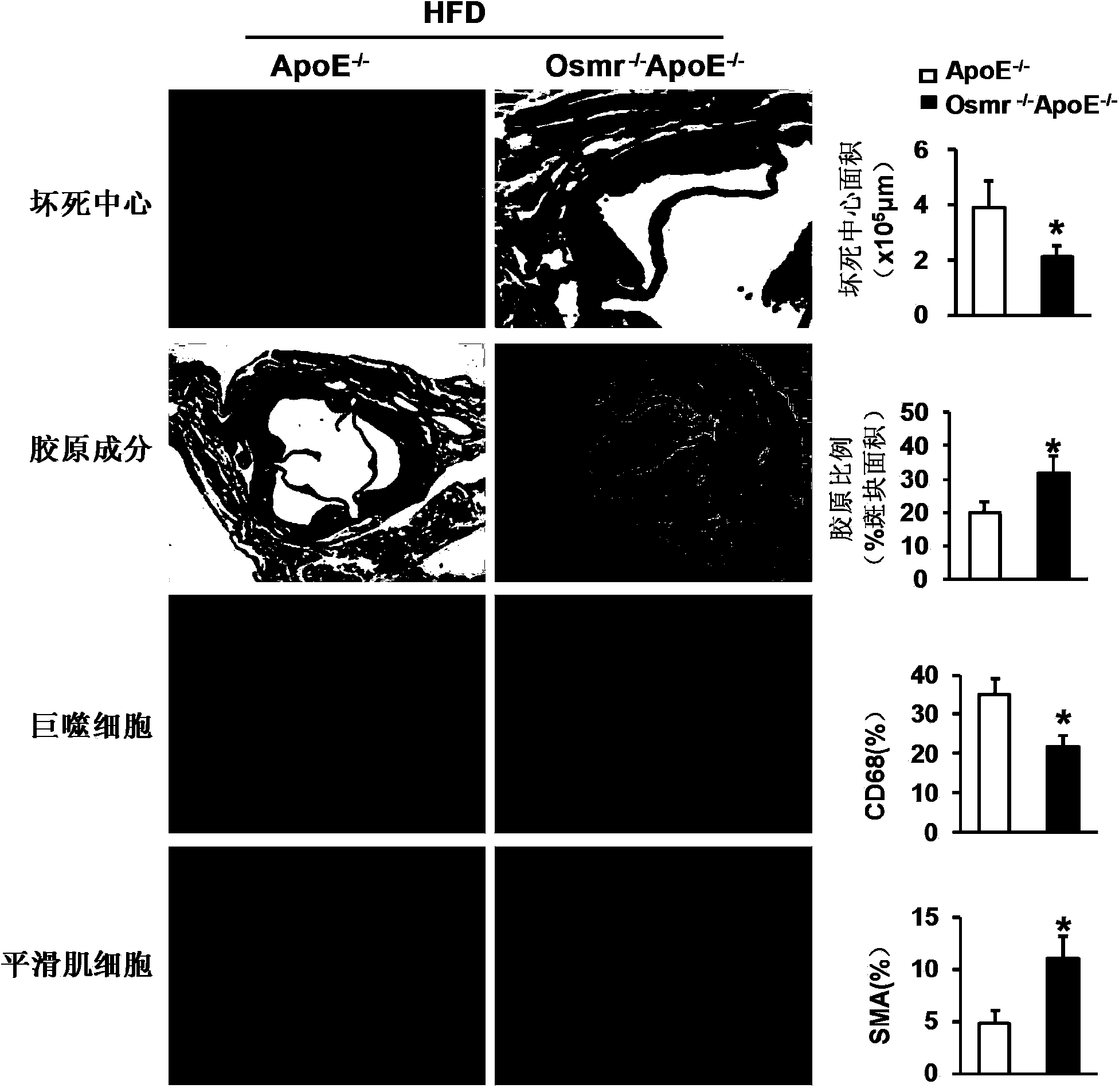 Function and application of II-type oncostatin M receptor in treating atherosclerosis