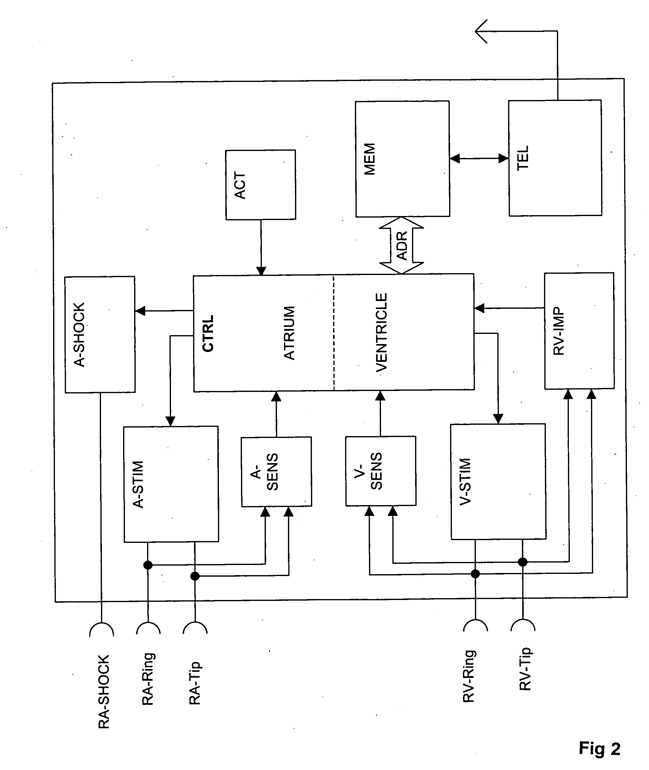 Atrial defibrillator