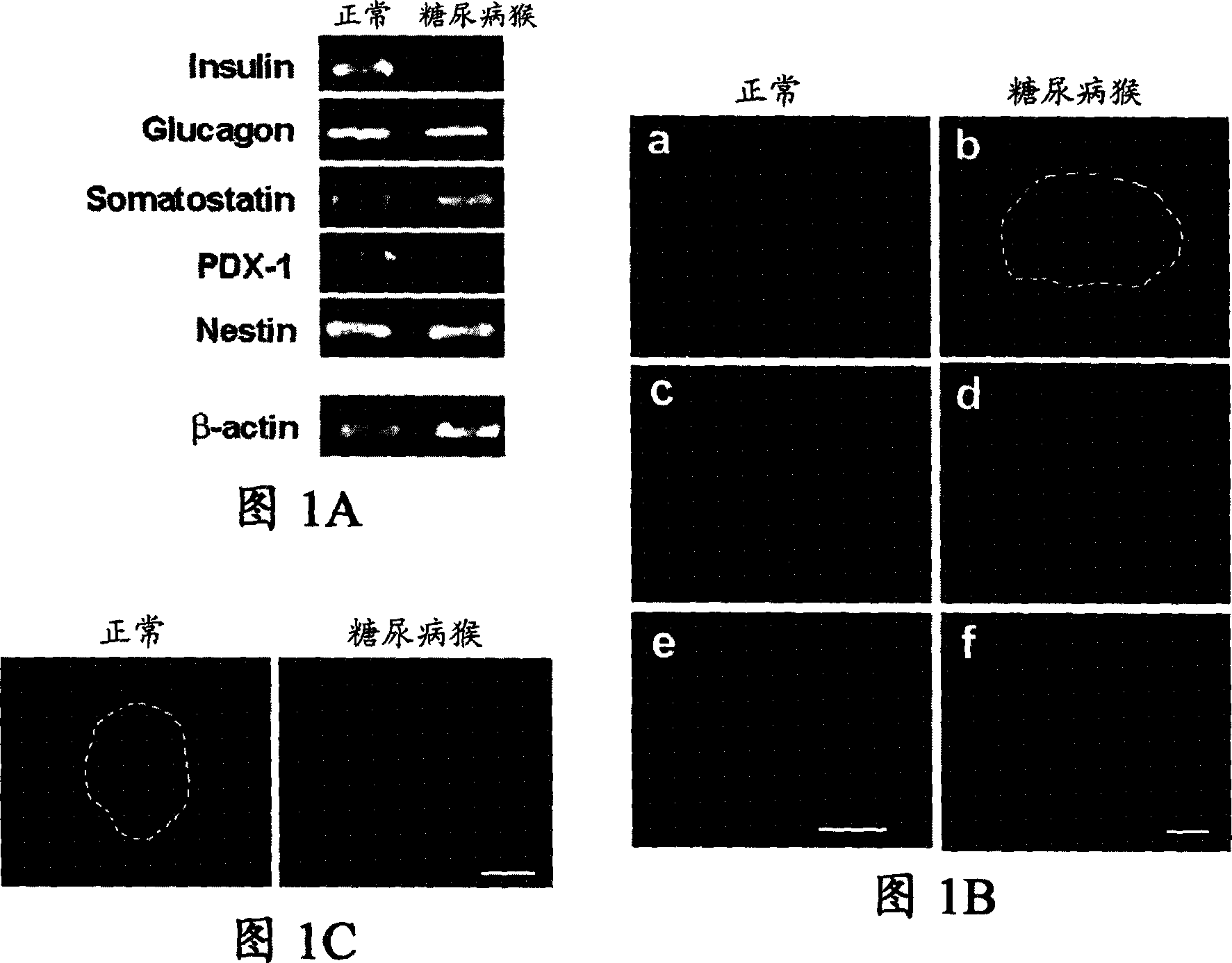 Cultured pancreatic cell, its culturing method and use