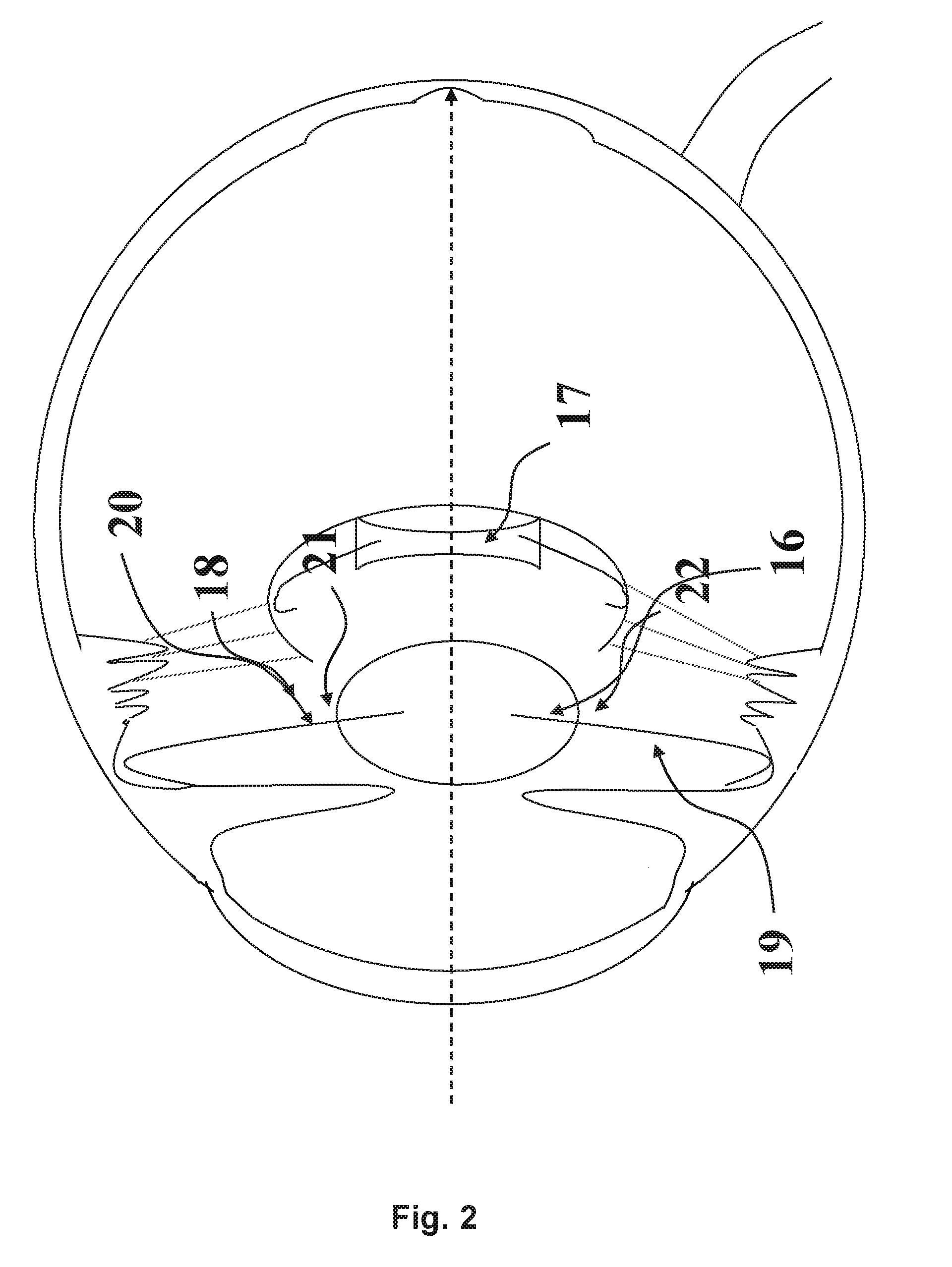 Intraocular Lens System