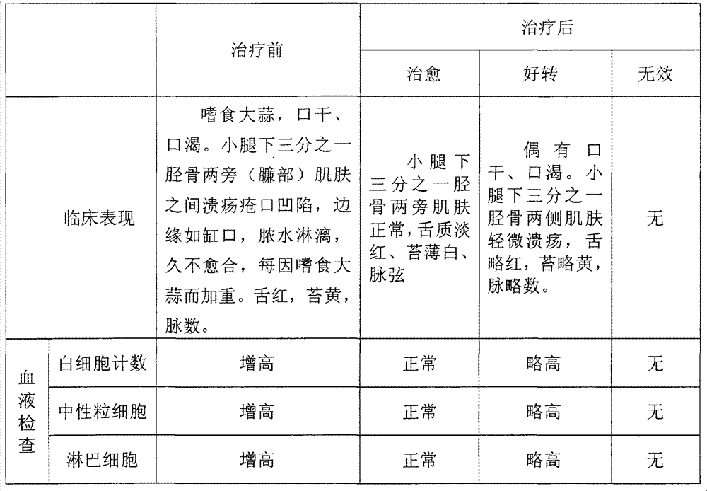 Preparation method of traditional Chinese medicine lotion for treating garlic-philic ecthyma