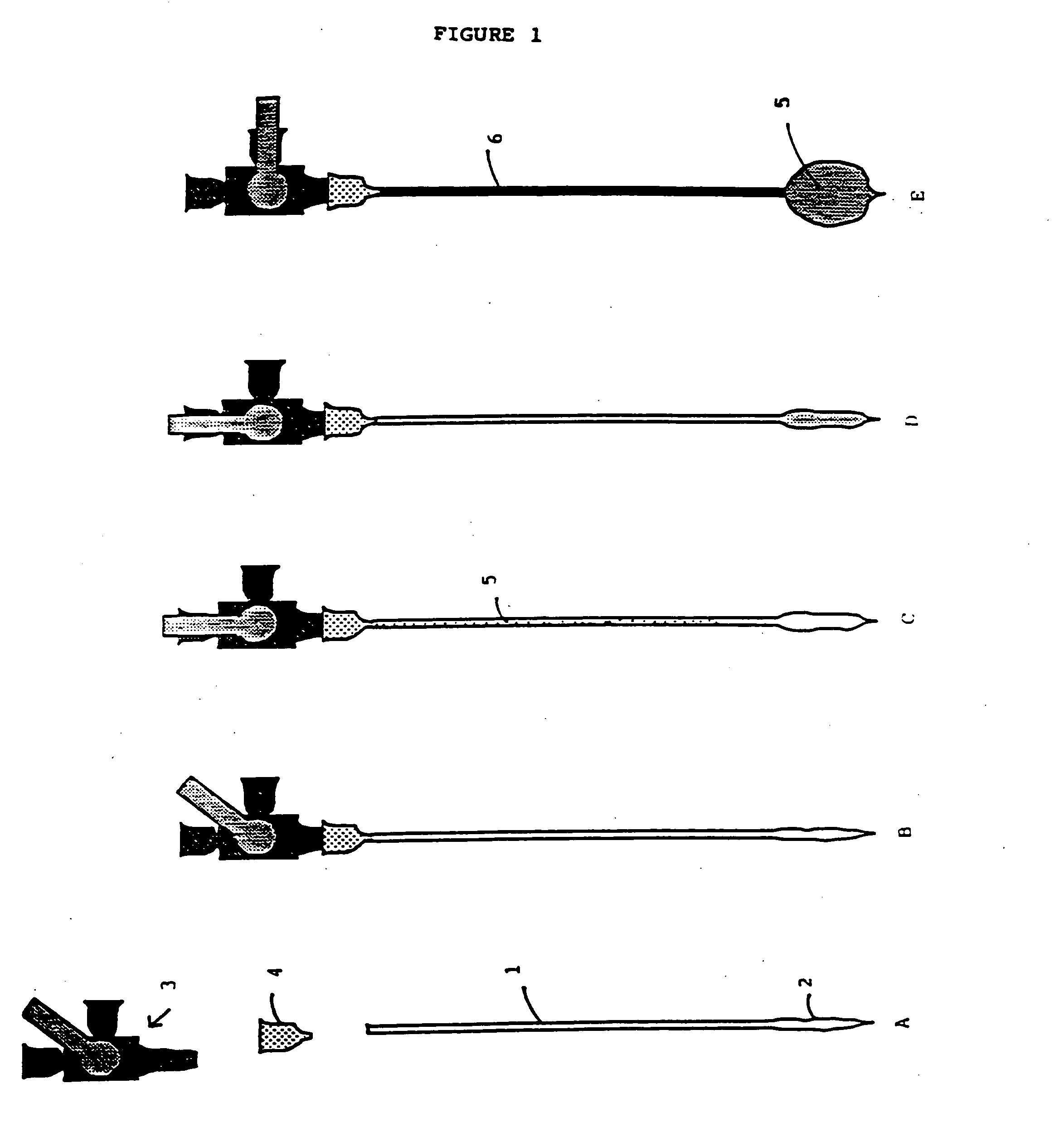 Compositions comprising a tissue glue and therapeutic agents