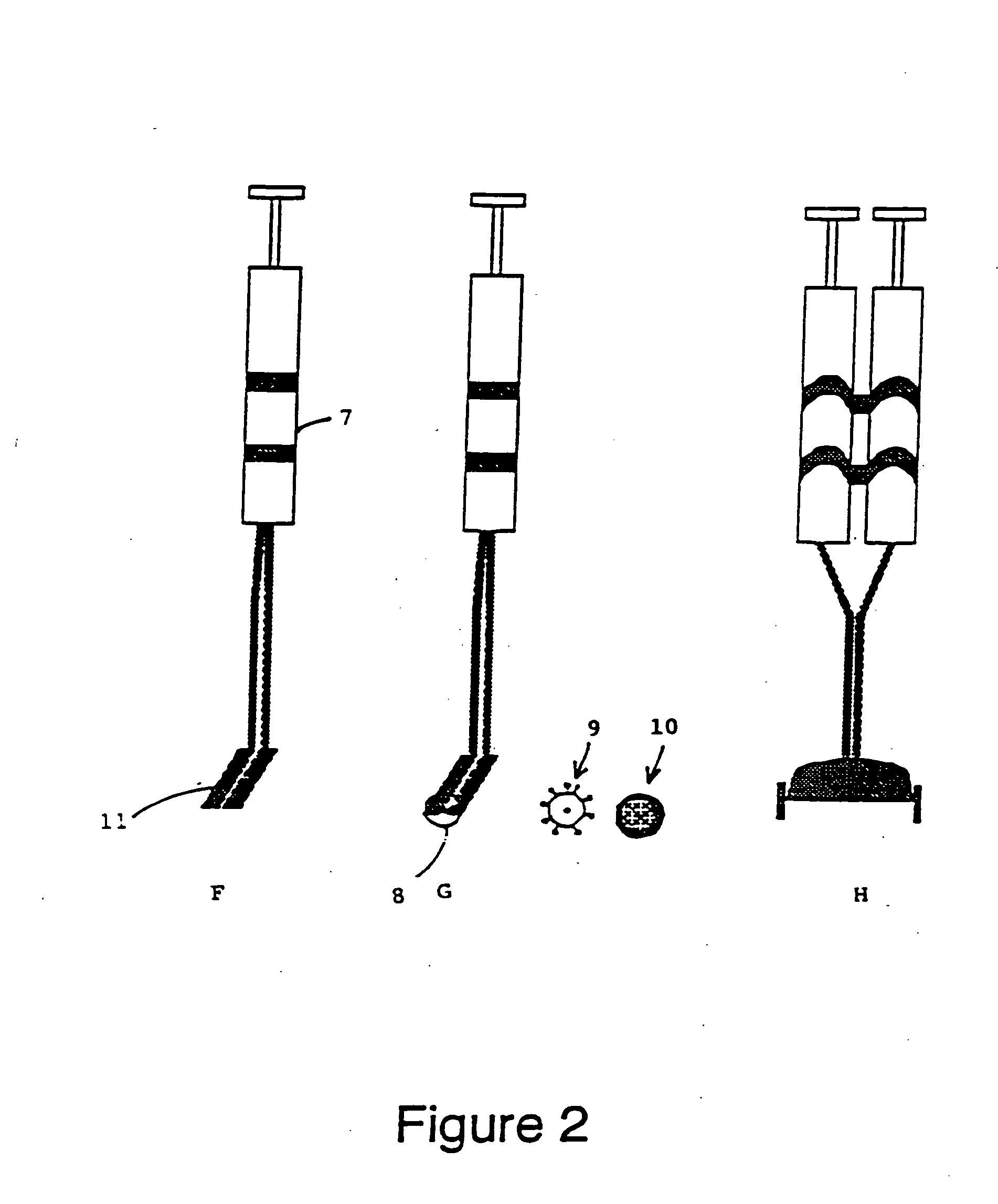 Compositions comprising a tissue glue and therapeutic agents