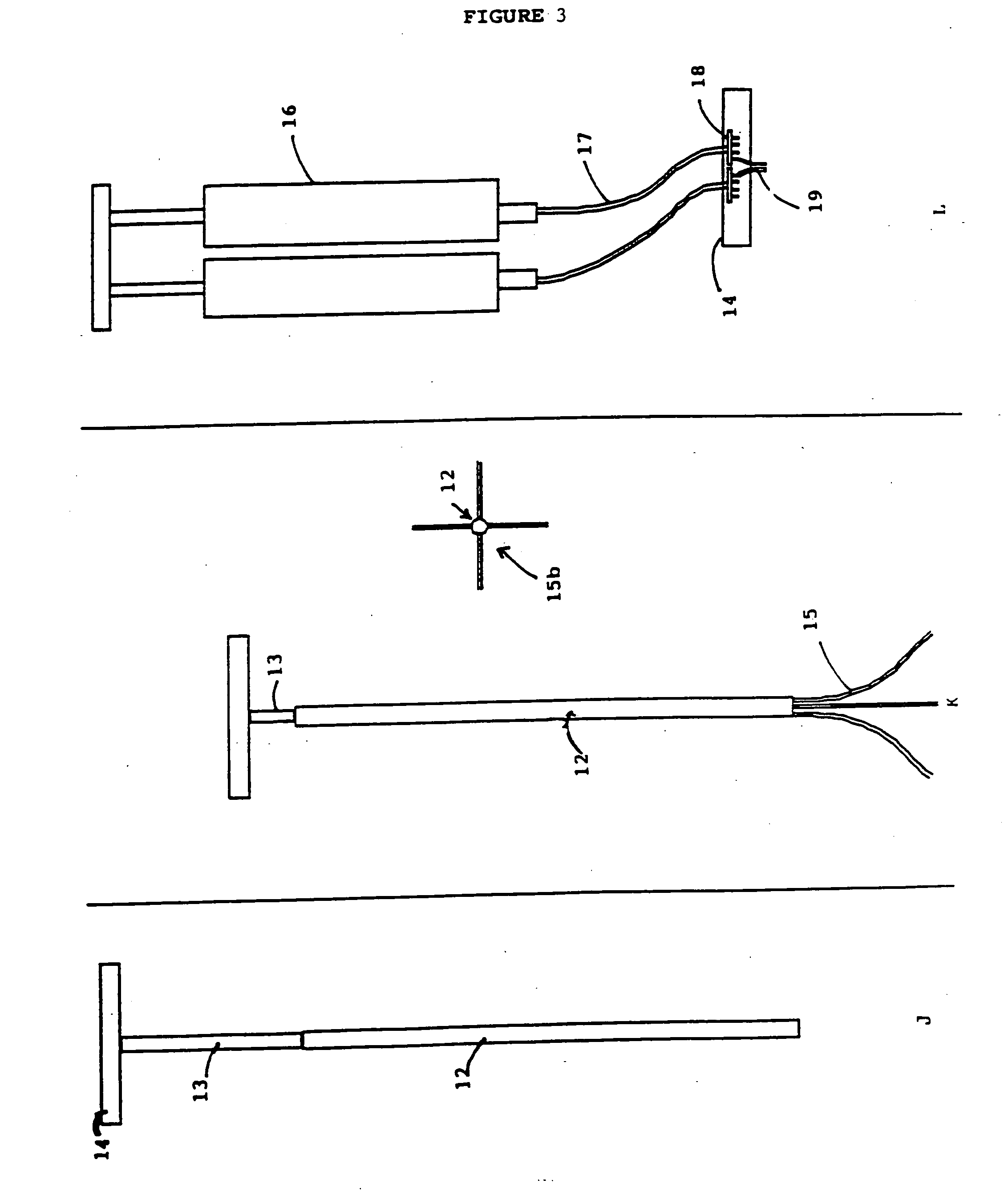 Compositions comprising a tissue glue and therapeutic agents