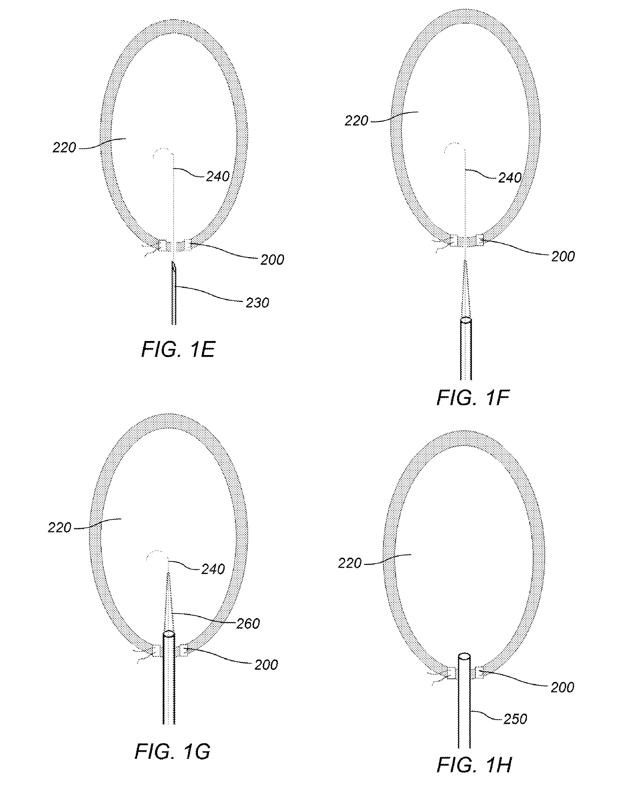 System and method for cutting trabeculae carneae of the left ventricle to increase LV compliance