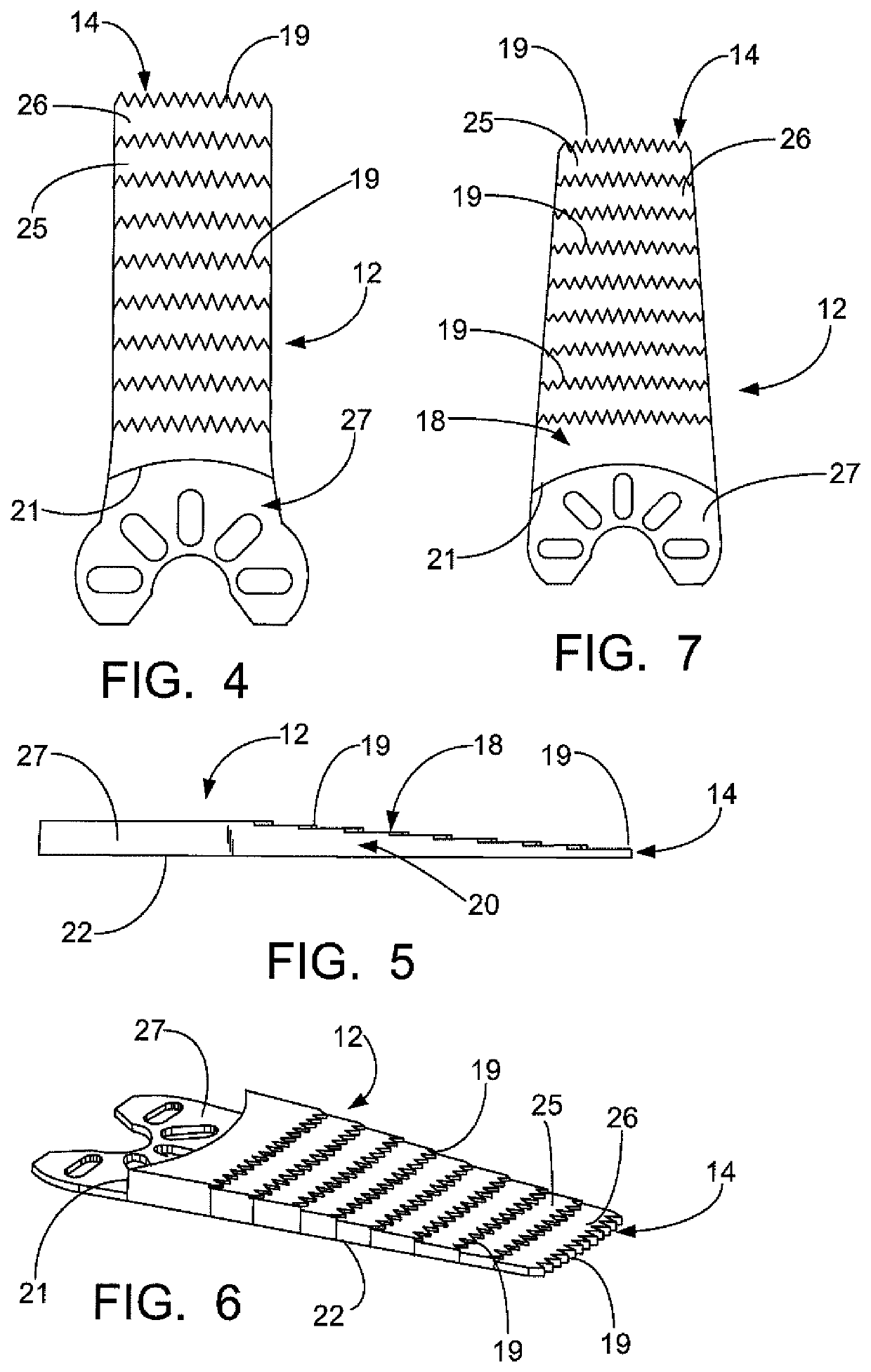 Surgical saw blade and method for wedge osteotomies