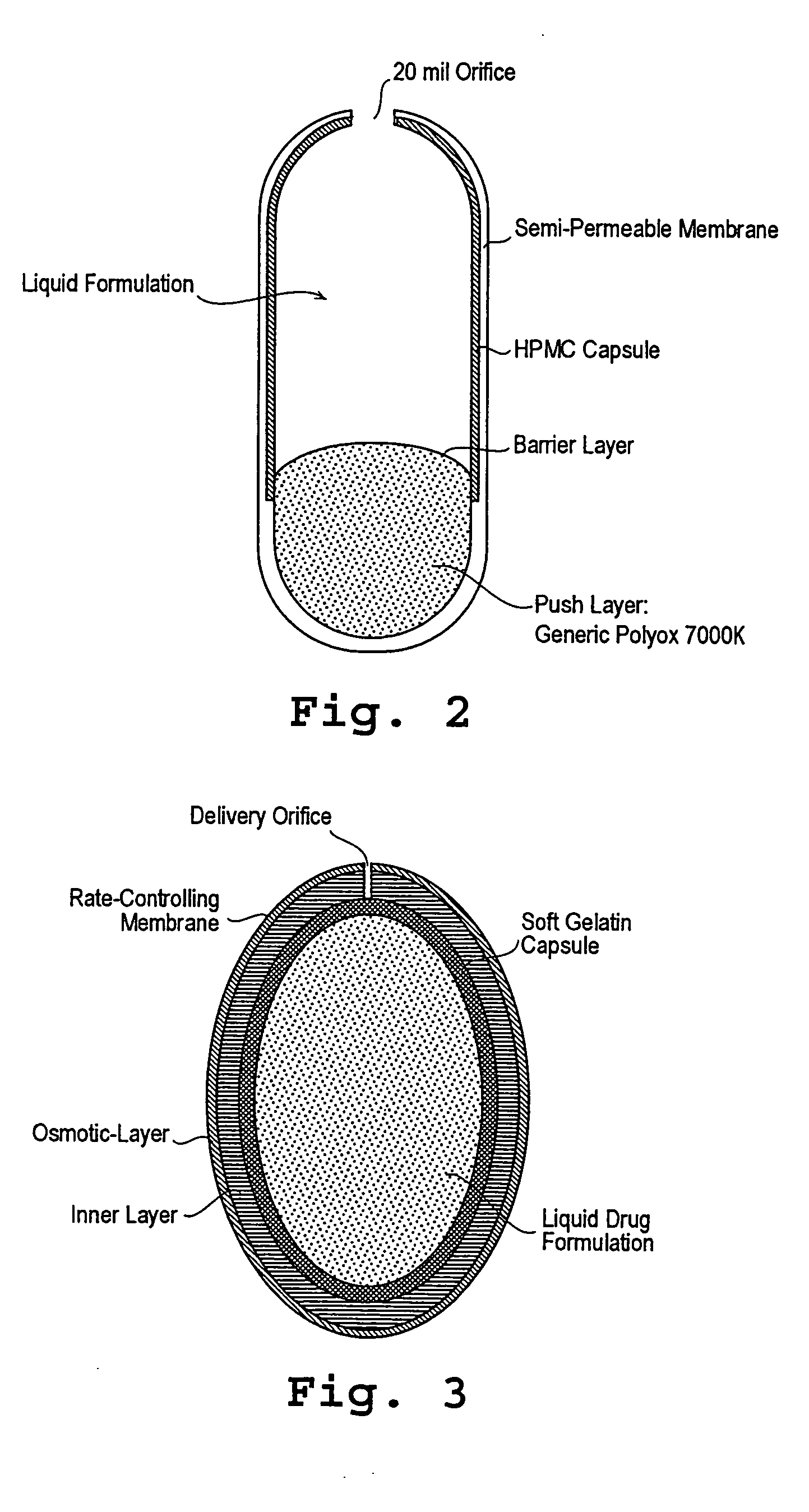 Administration of levodopa and carbidopa