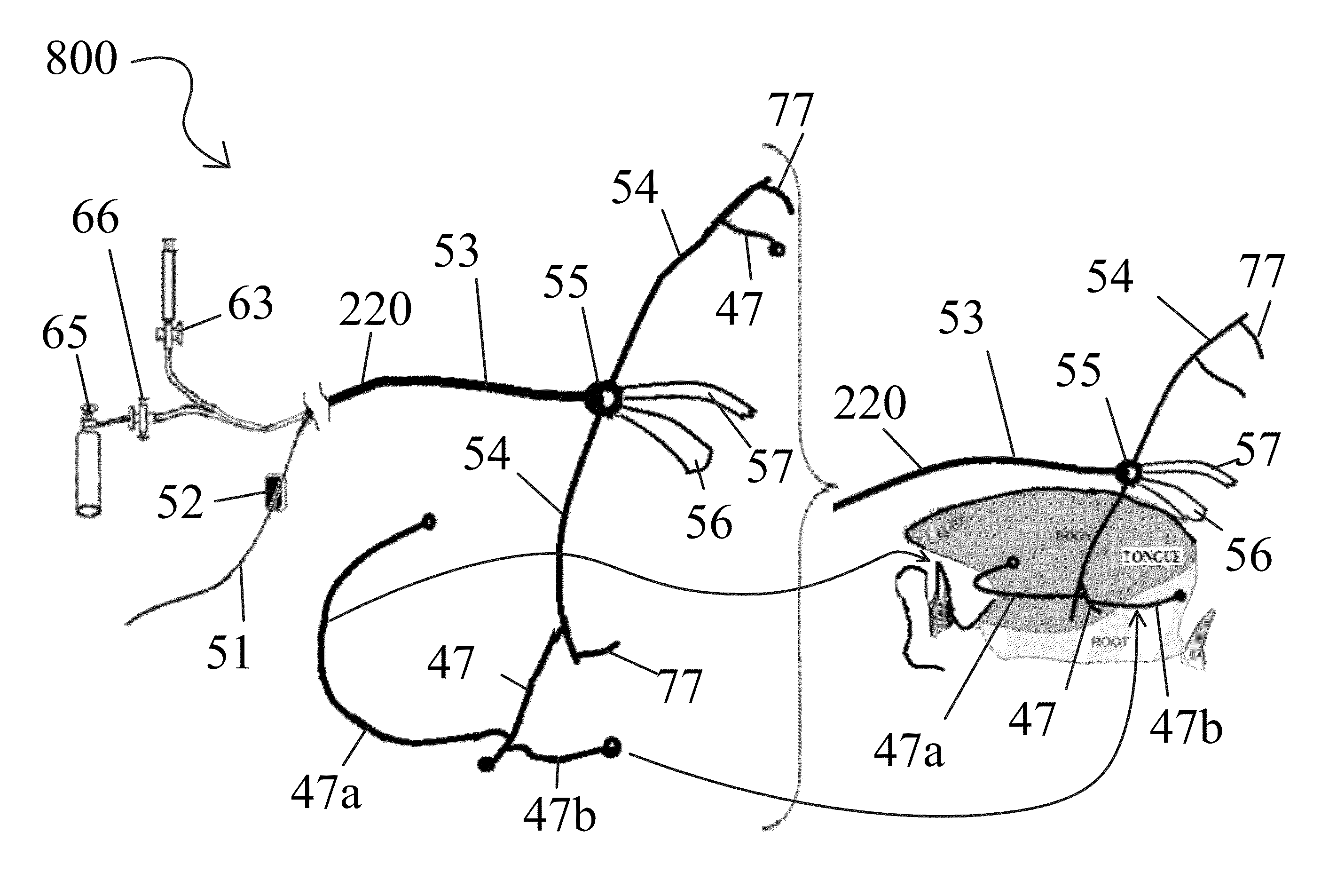 Snoring and obstructive sleep apnea prevention and treatment device