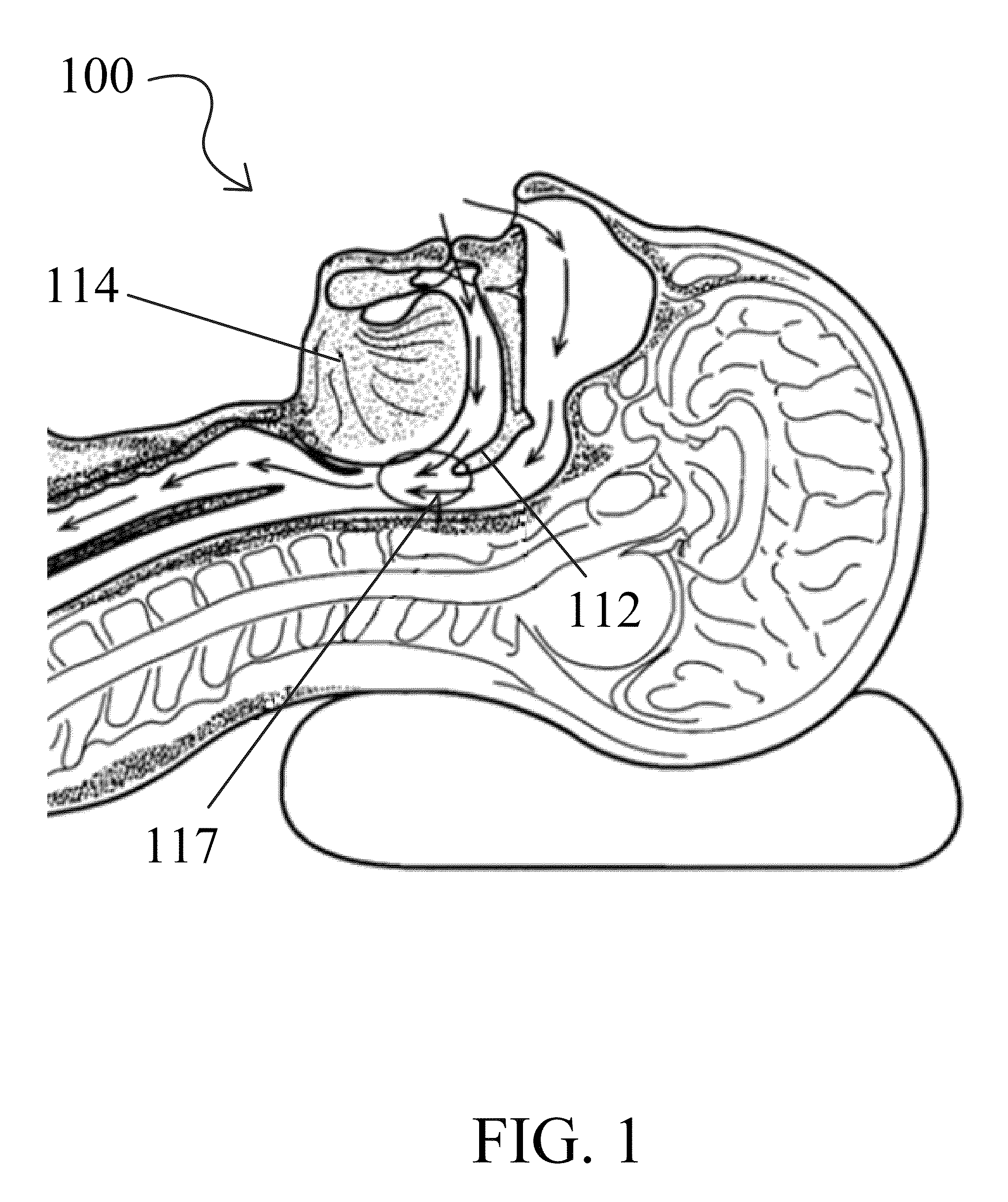 Snoring and obstructive sleep apnea prevention and treatment device