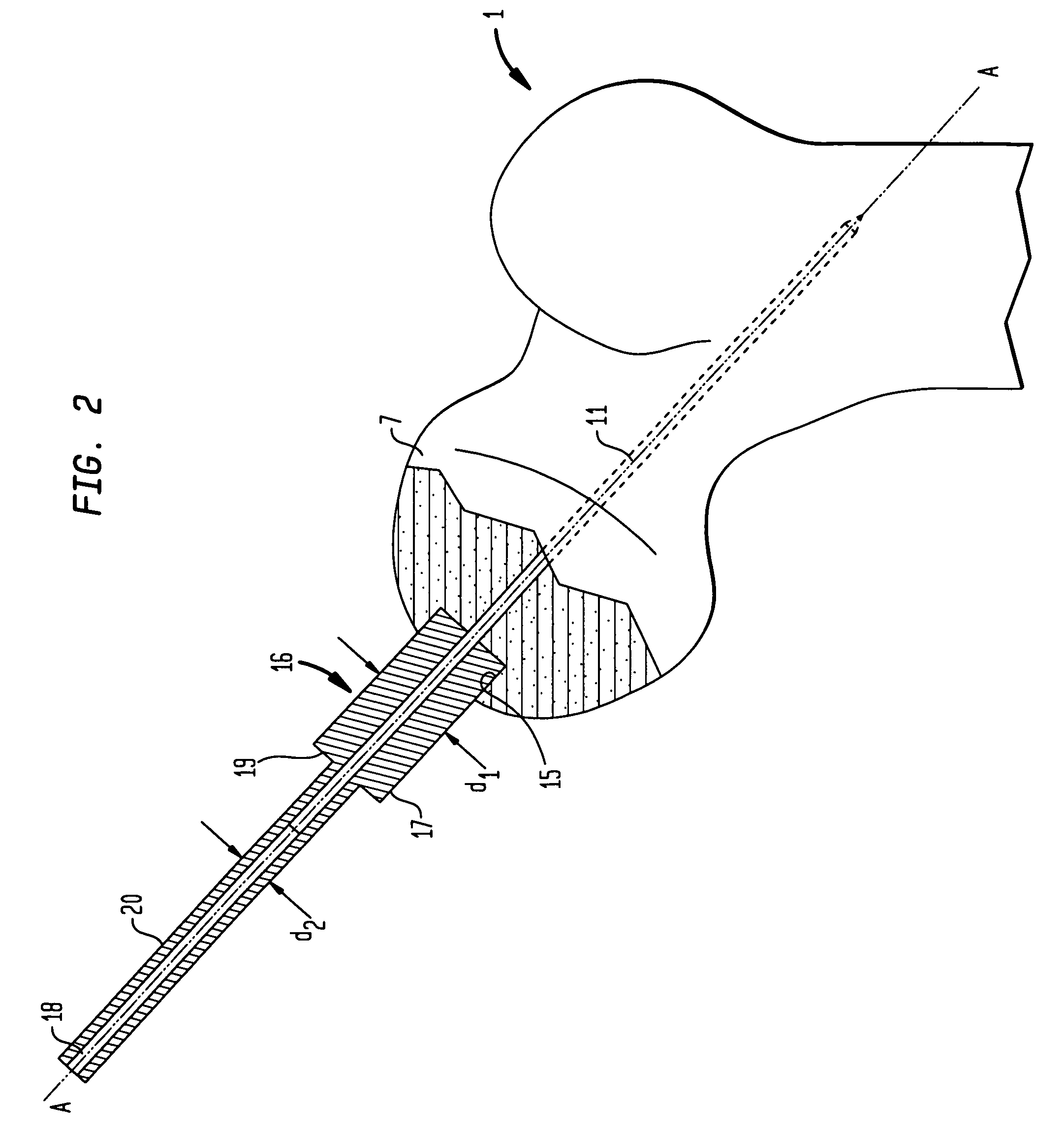 Offset tool guide for femoral head preparation