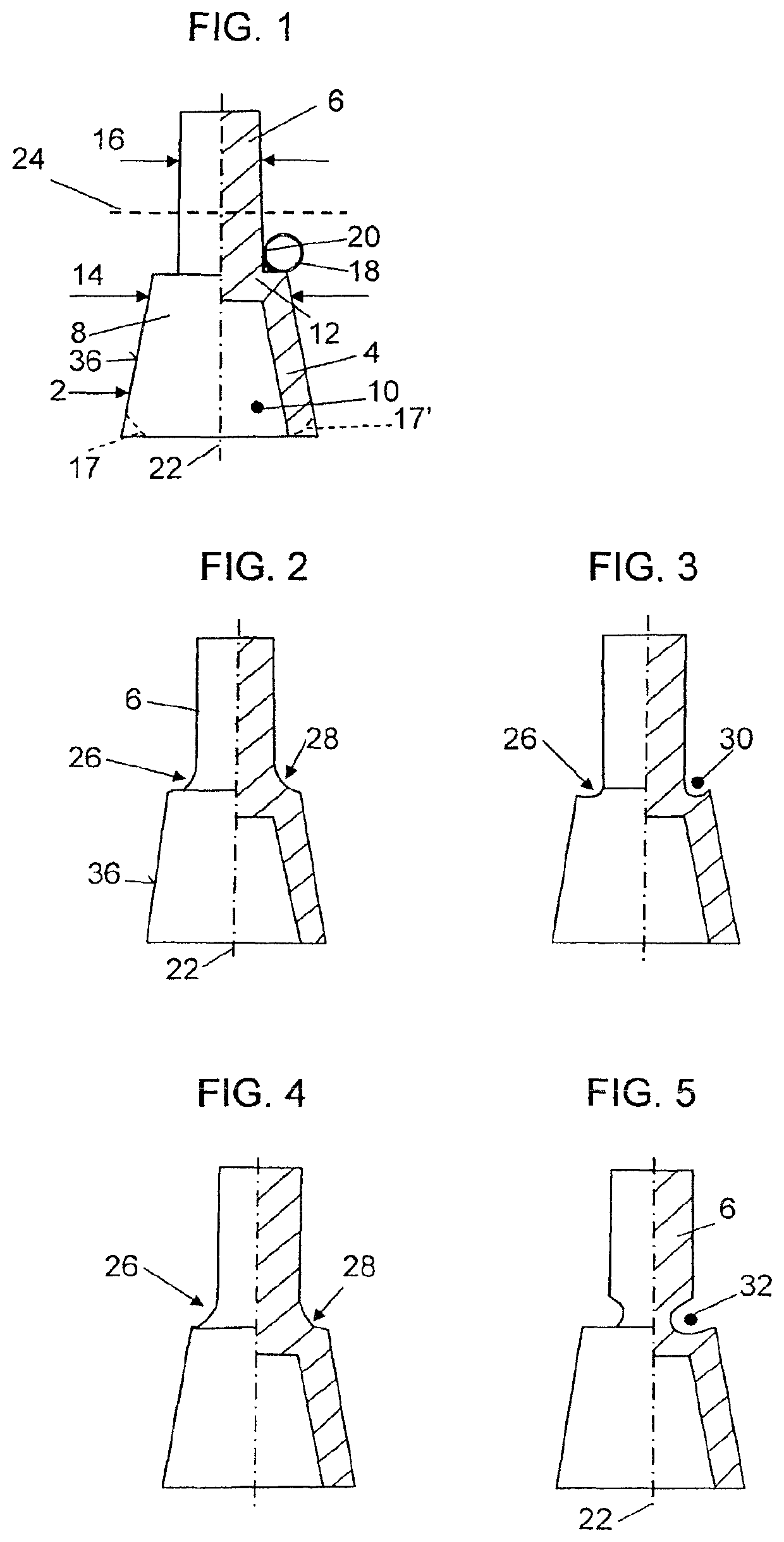 Dental prosthesis and method for the production thereof